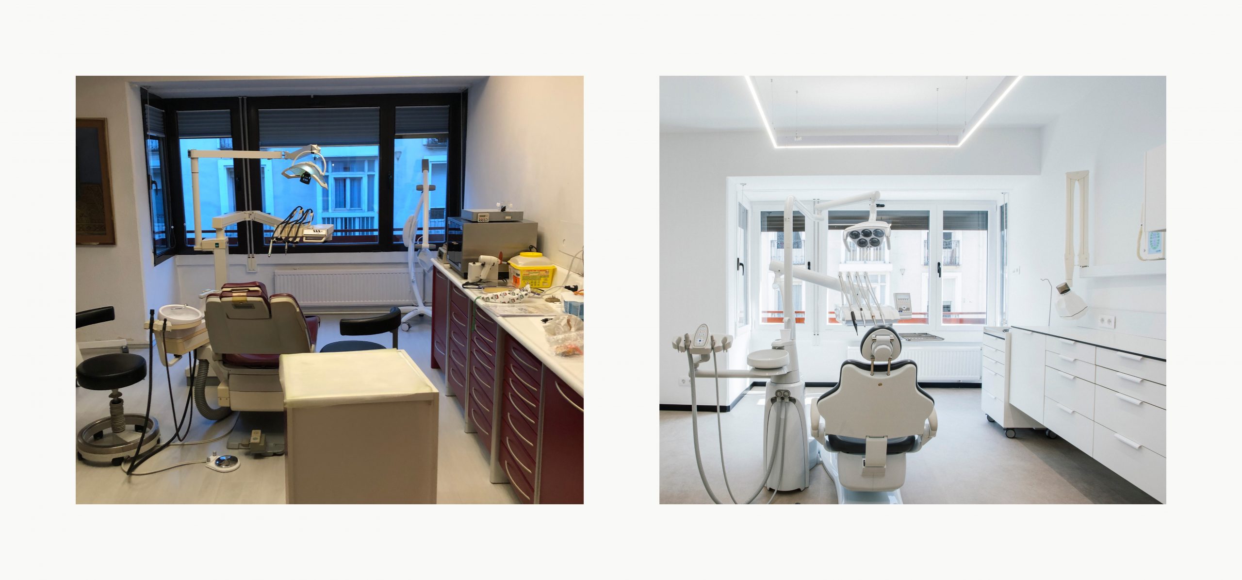 Romina Barbieri - clinica dental ayerdi_romina barbieri_vitoria_antes y despues5