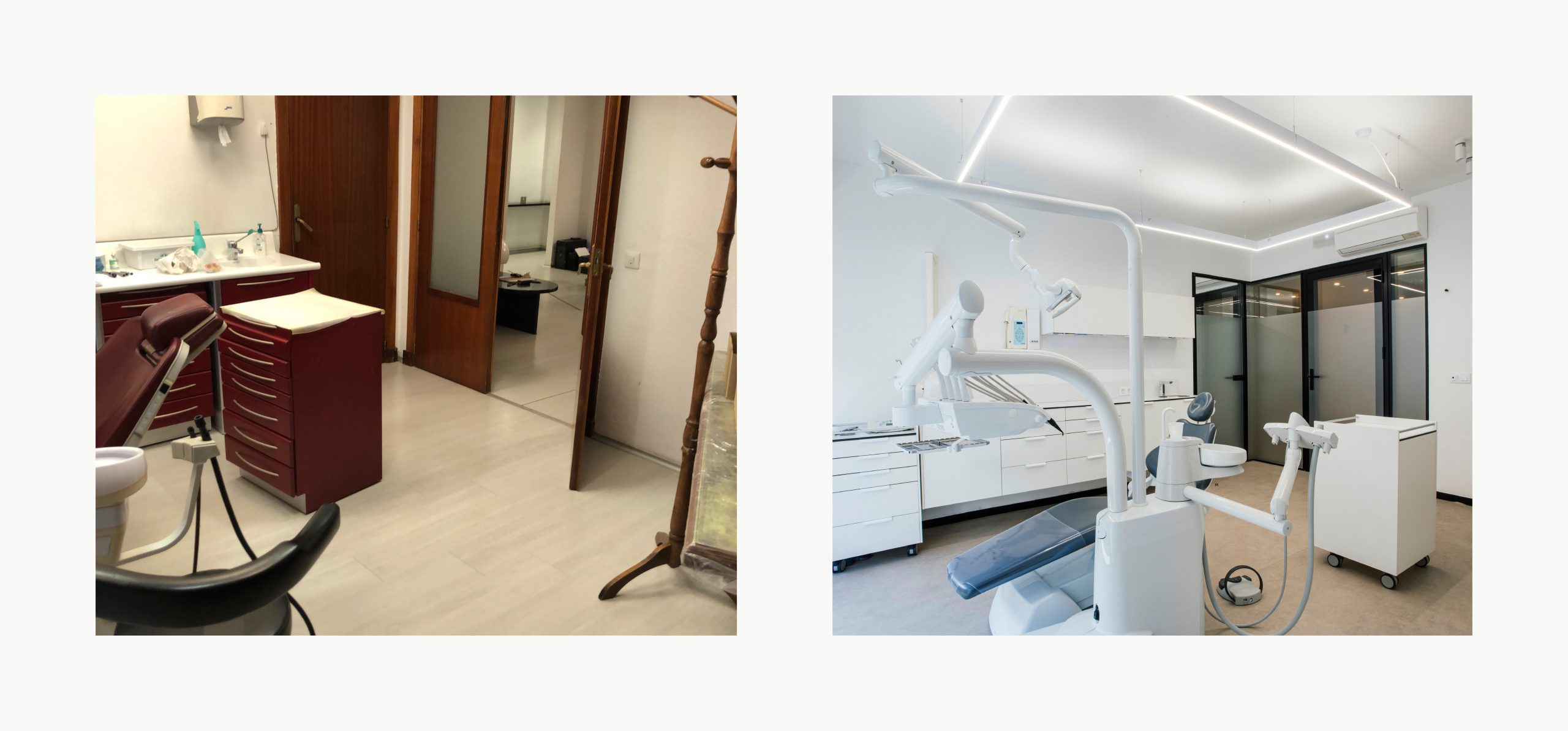 Romina Barbieri - clinica dental ayerdi_romina barbieri_vitoria_antes y despues7