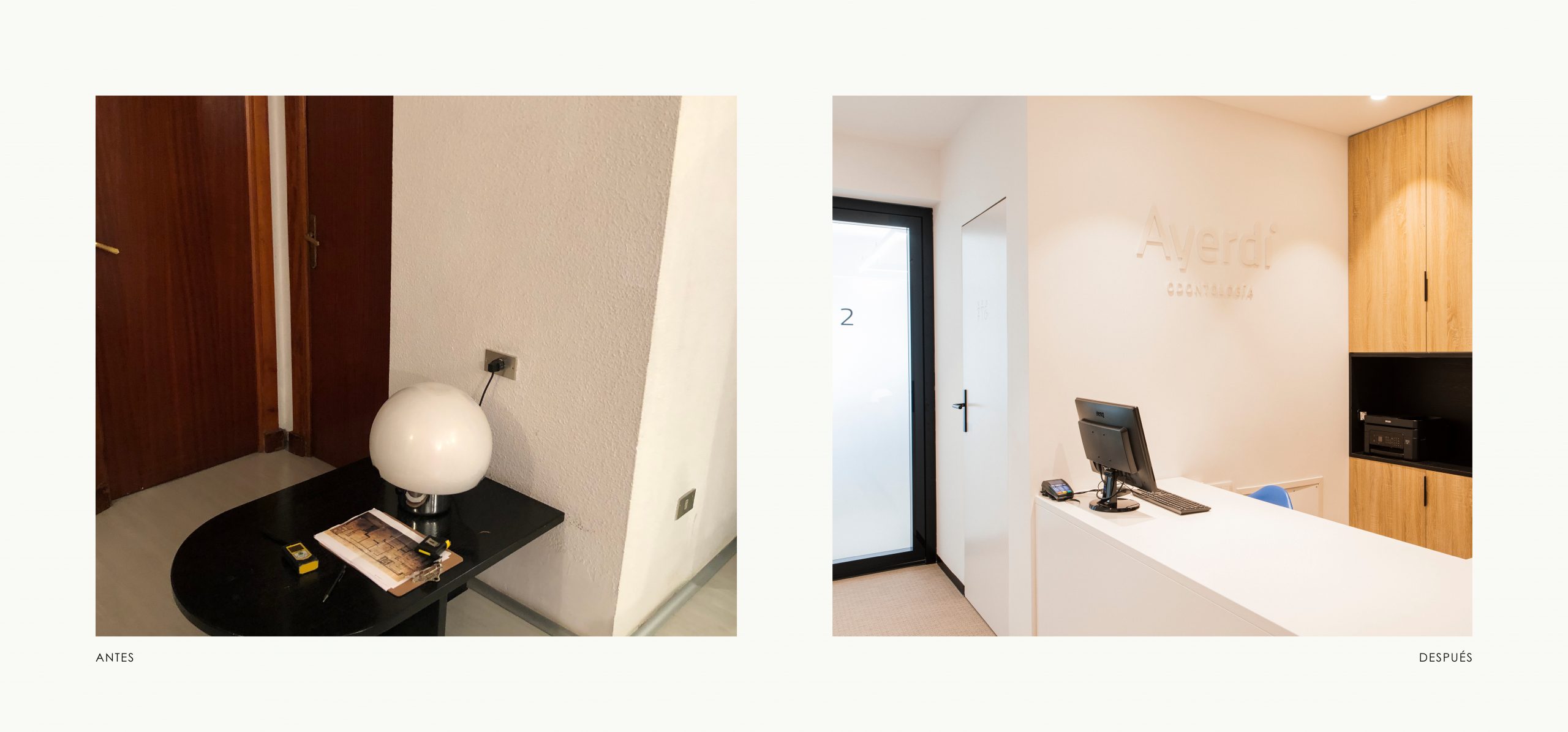 Romina Barbieri - clinica dental ayerdi_romina barbieri_vitoria_antes y despues_3