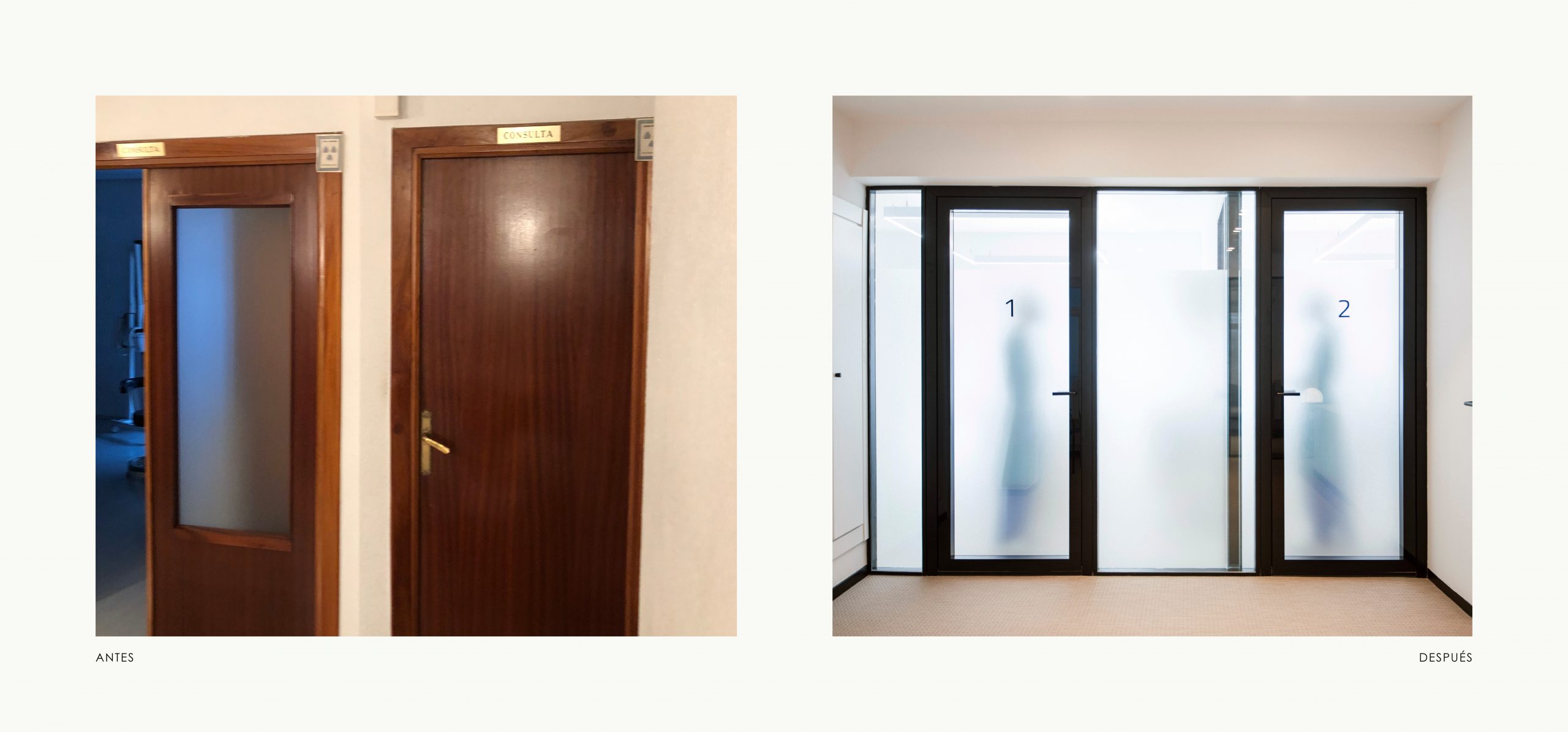 Romina Barbieri - clinica dental ayerdi_romina barbieri_vitoria_antes y despues_4