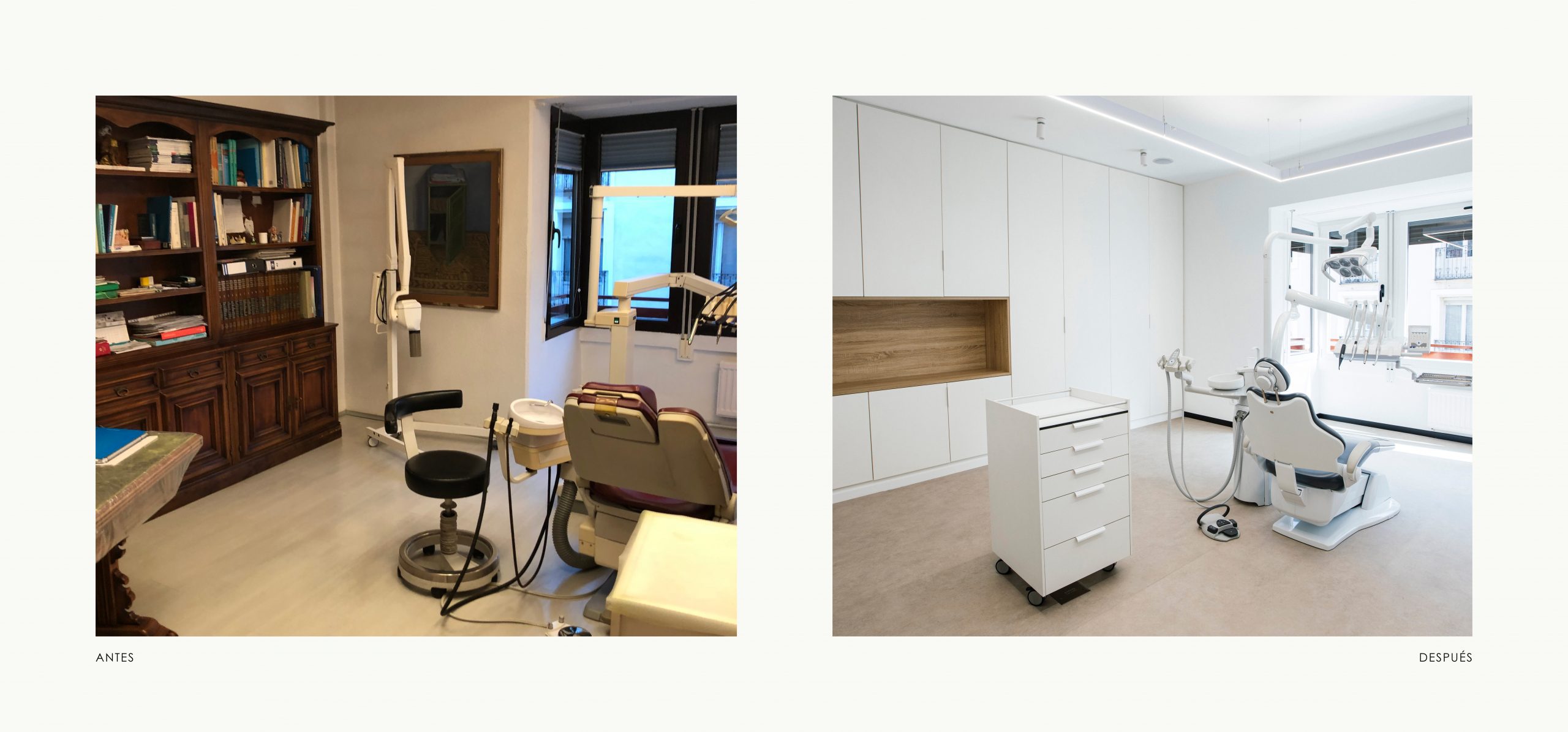 Romina Barbieri - clinica dental ayerdi_romina barbieri_vitoria_antes y despues_6