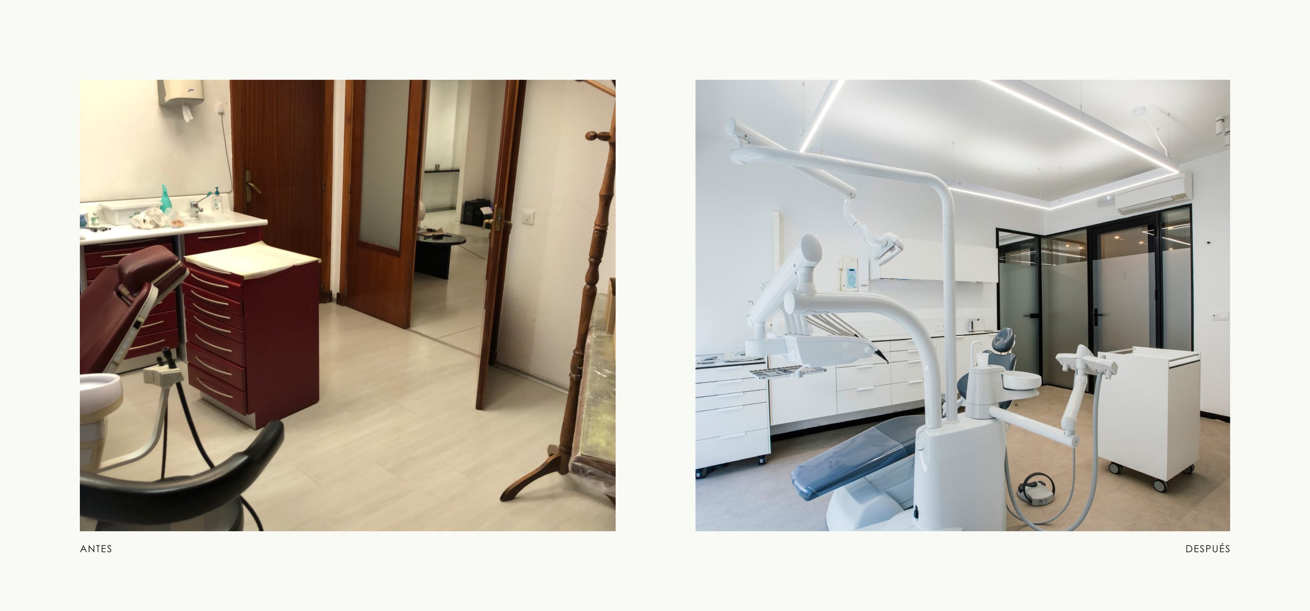 Romina Barbieri - clinica dental ayerdi_romina barbieri_vitoria_antes y despues_7