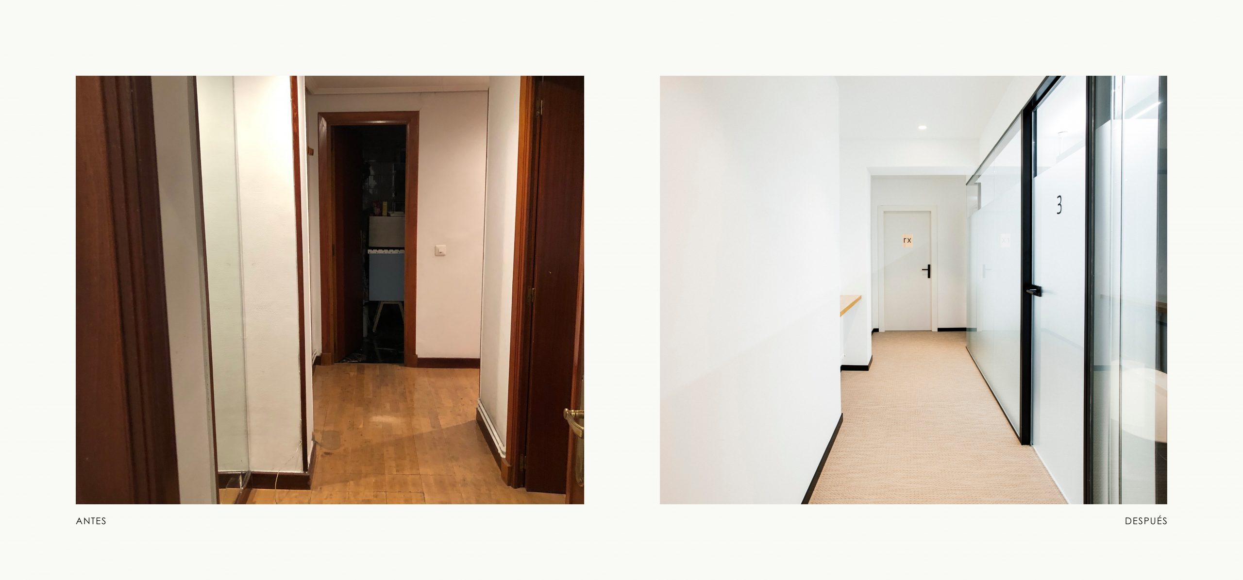 Romina Barbieri - clinica dental ayerdi_romina barbieri_vitoria_antes y despues_8