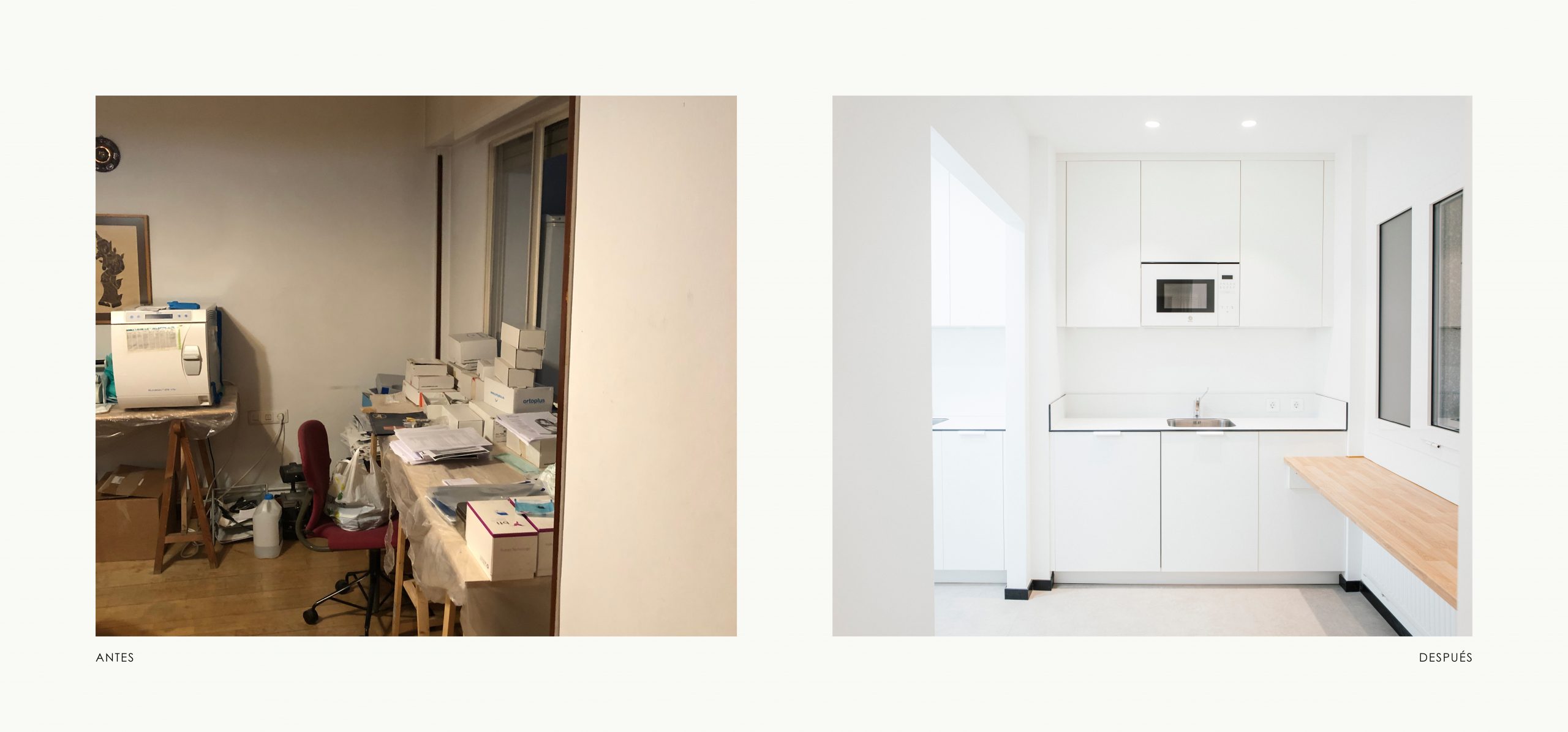 Romina Barbieri - clinica dental ayerdi_romina barbieri_vitoria_antes y despues_9