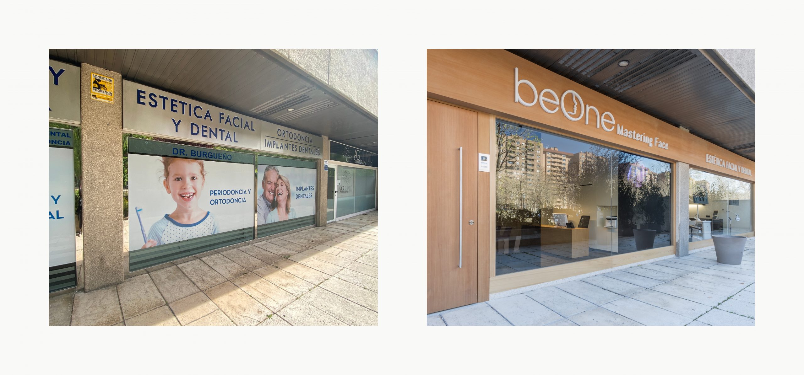 Romina Barbieri - clinica dental beONE_Mastering Face_romina barbieri_madrid_antes y despues