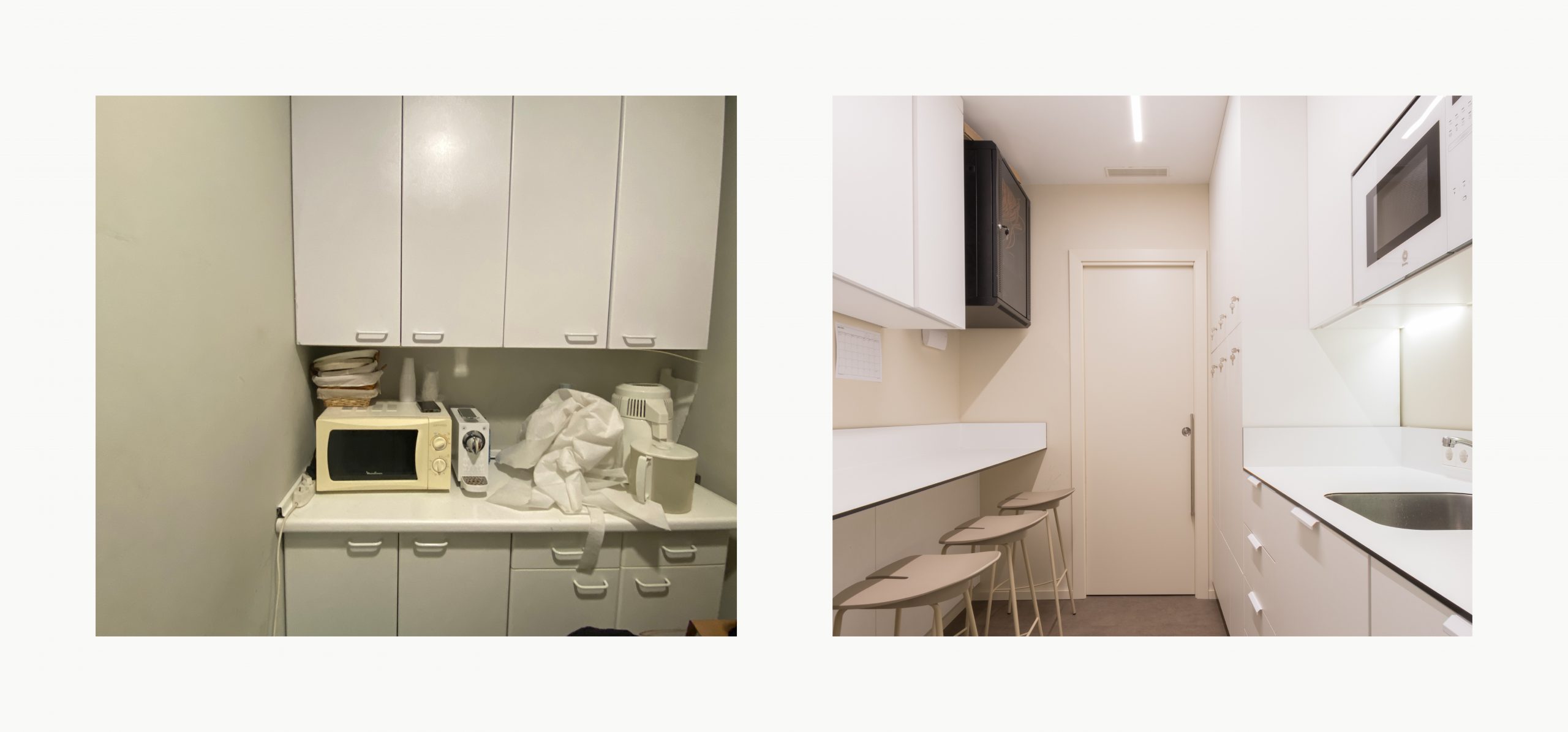 Romina Barbieri - clinica dental beONE_Mastering Face_romina barbieri_madrid_antes y despues11