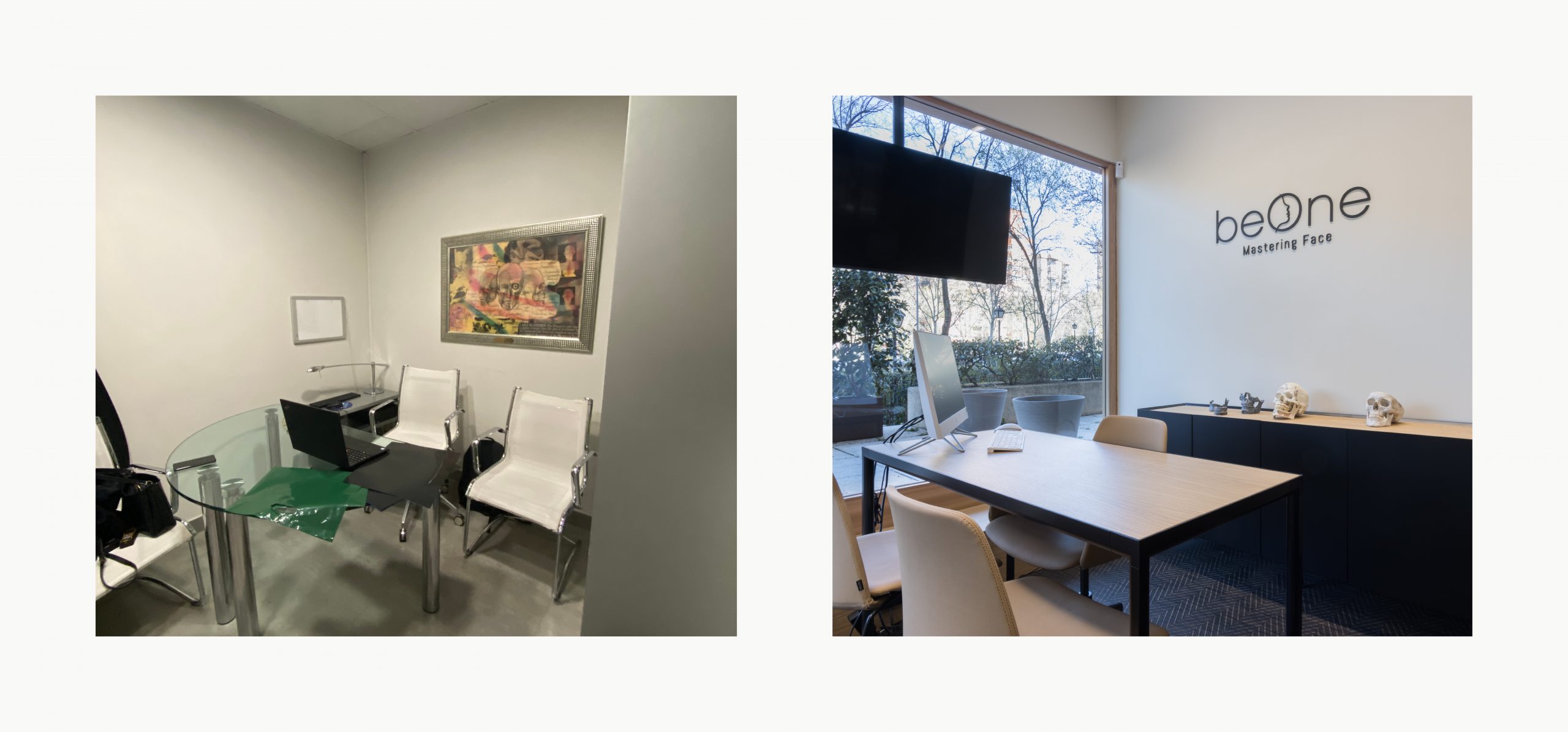 Romina Barbieri - clinica dental beONE_Mastering Face_romina barbieri_madrid_antes y despues7