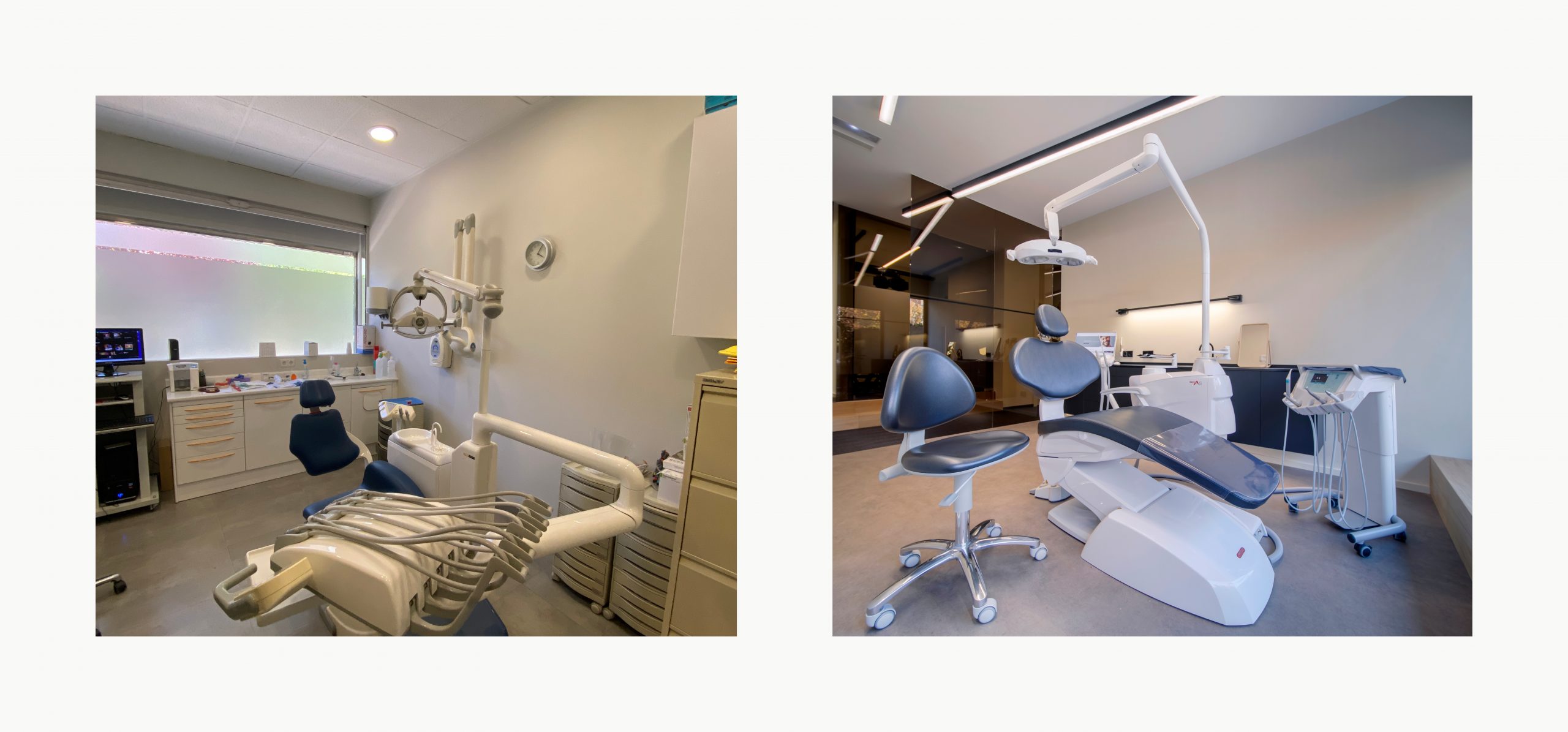 Romina Barbieri - clinica dental beONE_Mastering Face_romina barbieri_madrid_antes y despues8