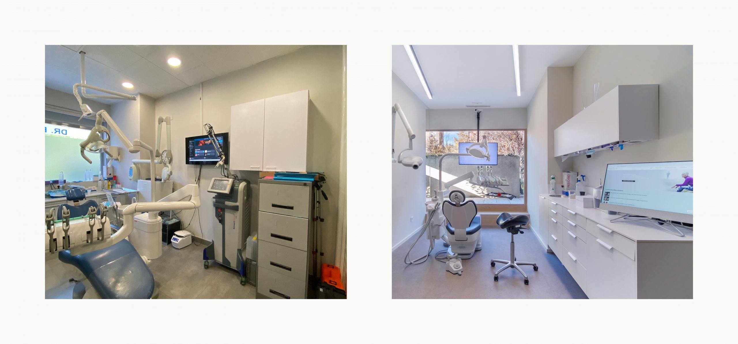 Romina Barbieri - clinica dental beONE_Mastering Face_romina barbieri_madrid_antes y despues9