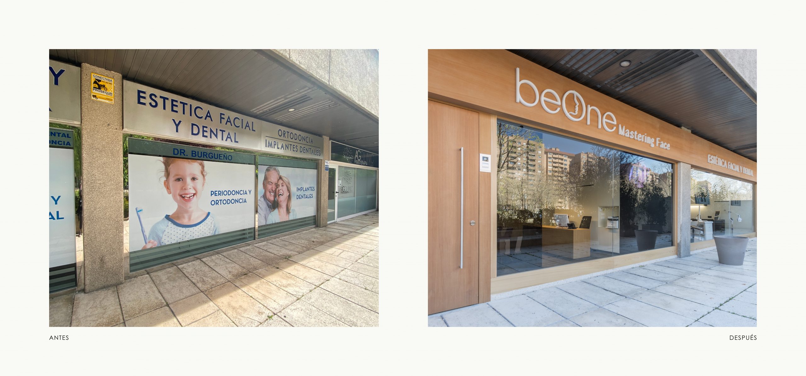 Romina Barbieri - clinica dental beONE_Mastering Face_romina barbieri_madrid_antes y despues_1