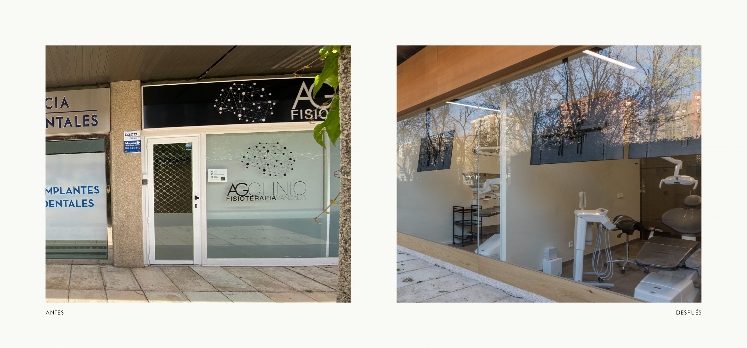 Romina Barbieri - clinica dental beONE_Mastering Face_romina barbieri_madrid_antes y despues_2