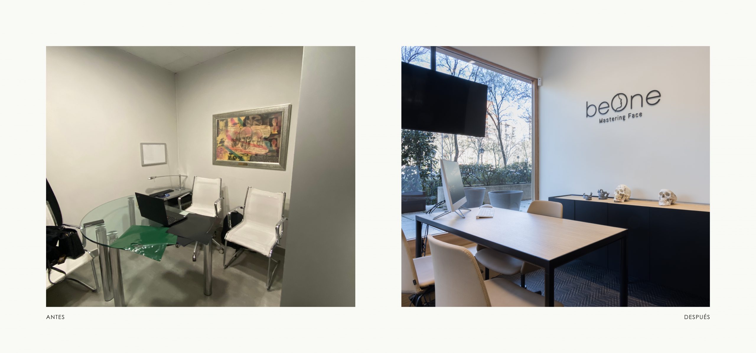 Romina Barbieri - clinica dental beONE_Mastering Face_romina barbieri_madrid_antes y despues_7