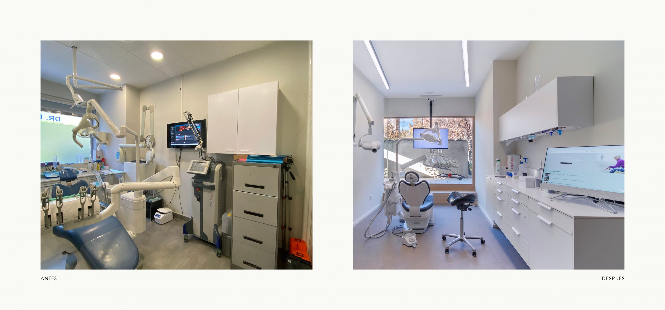 Romina Barbieri - clinica dental beONE_Mastering Face_romina barbieri_madrid_antes y despues_9