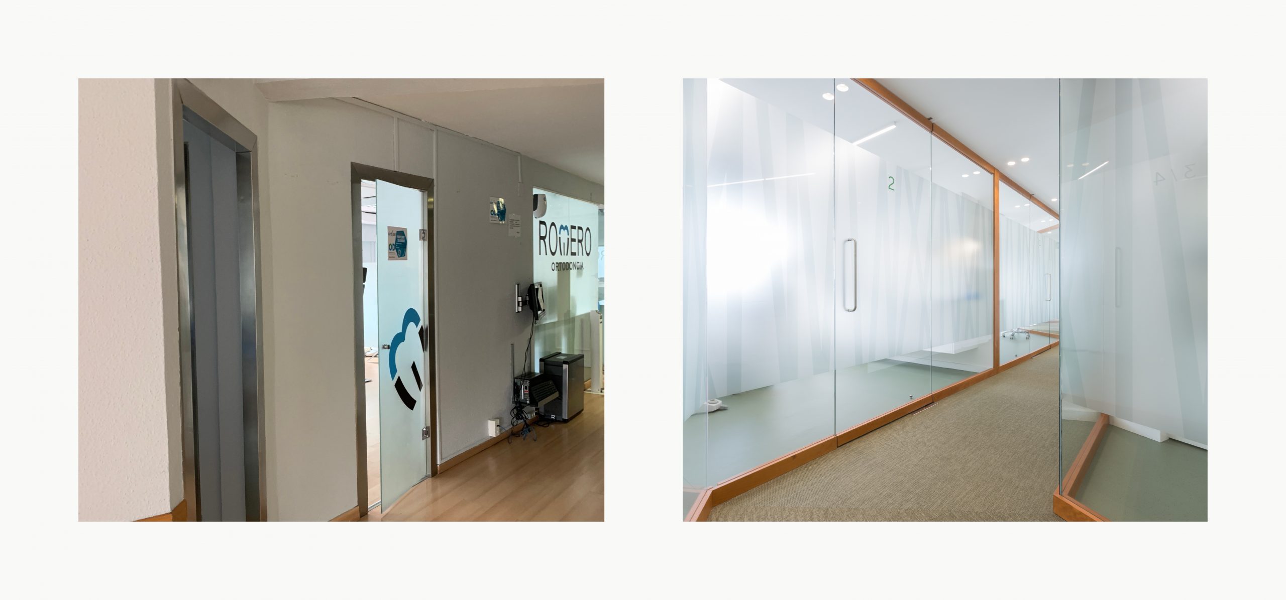 Romina Barbieri - clinica dental doctores romero_romina barbieri_madrid_antes y despues3