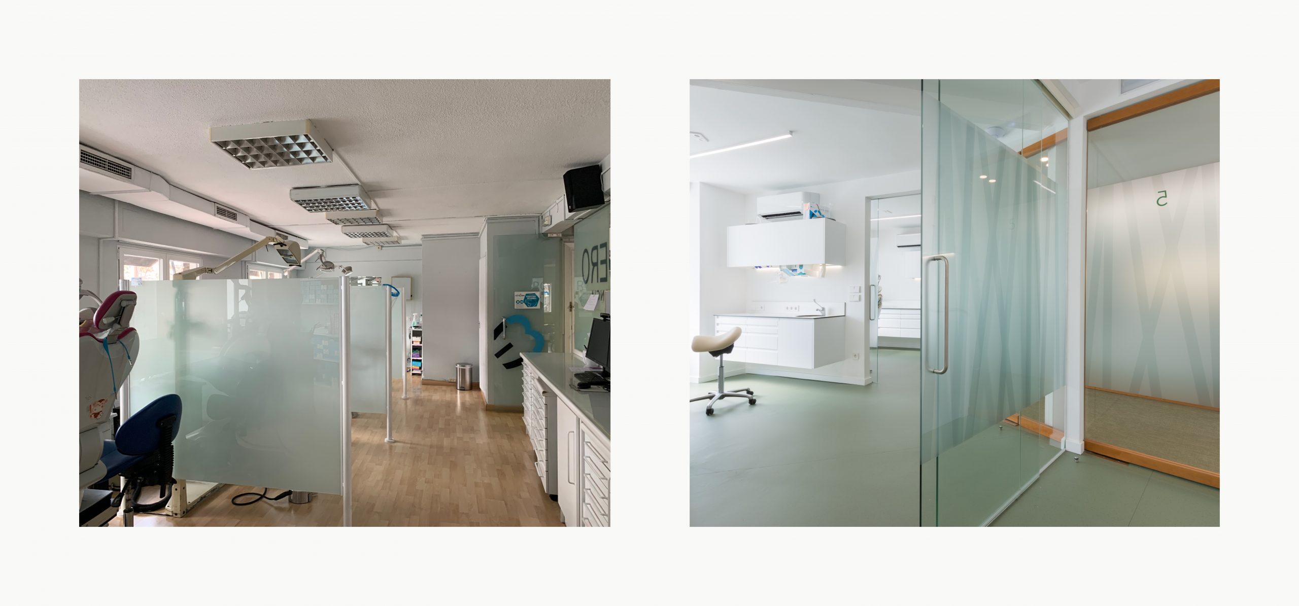 Romina Barbieri - clinica dental doctores romero_romina barbieri_madrid_antes y despues4