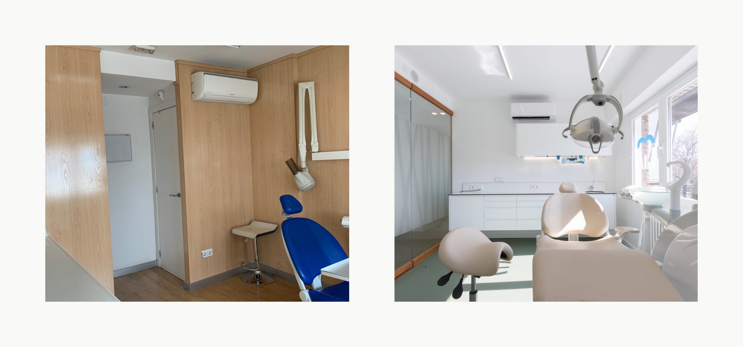 Romina Barbieri - clinica dental doctores romero_romina barbieri_madrid_antes y despues6