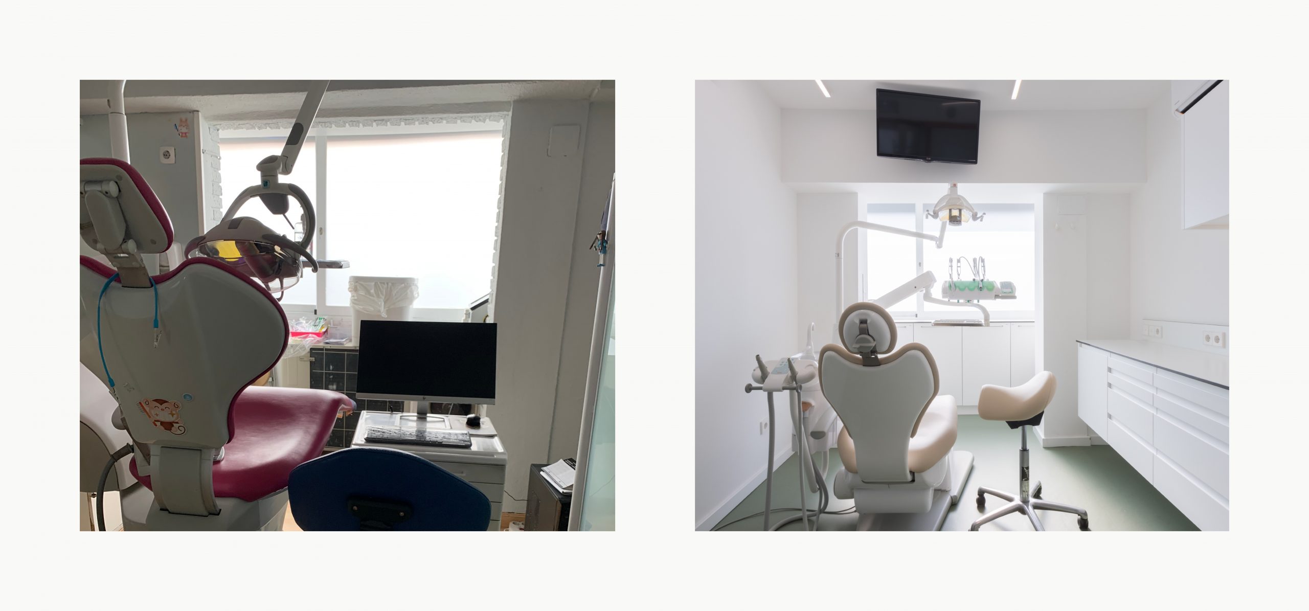Romina Barbieri - clinica dental doctores romero_romina barbieri_madrid_antes y despues7