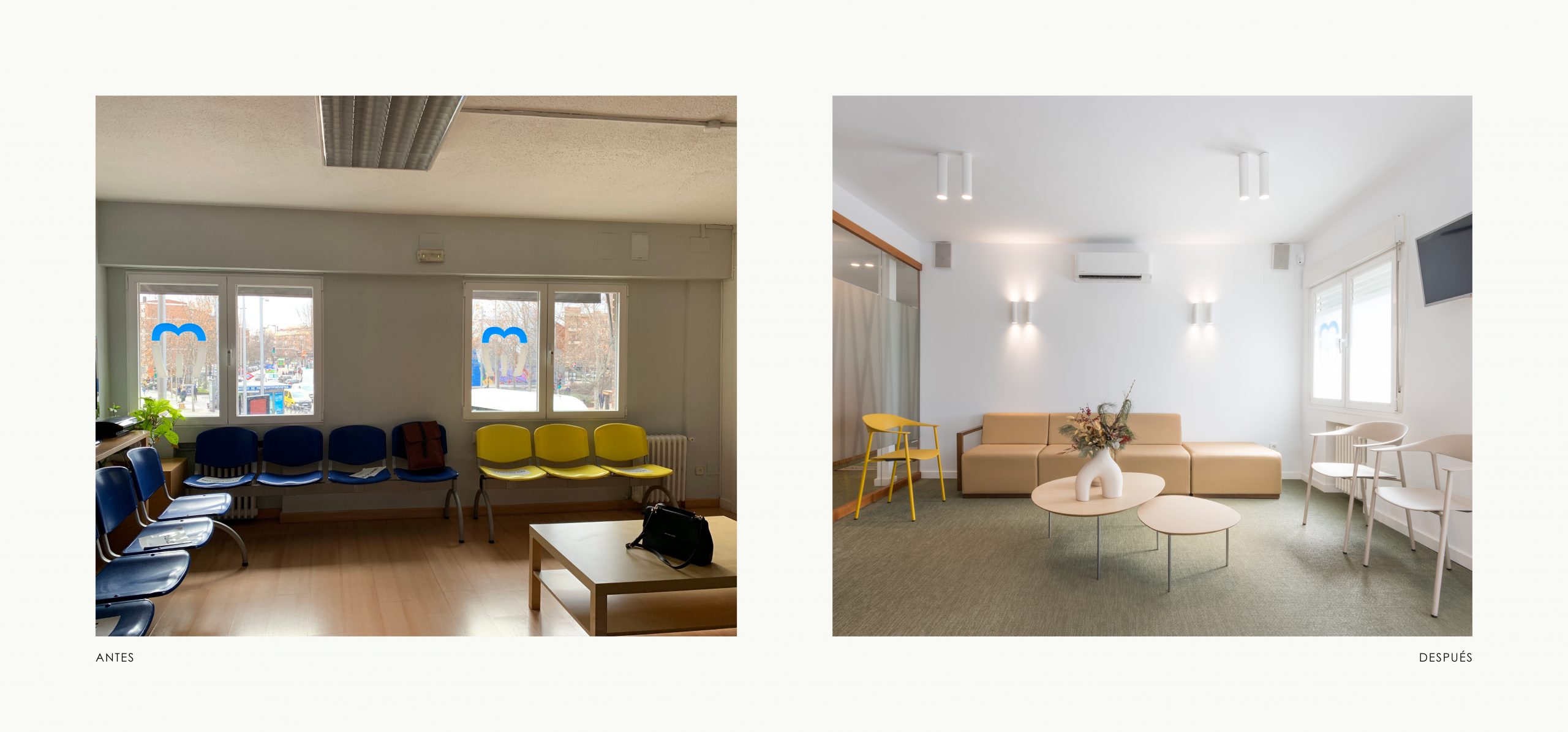 Romina Barbieri - clinica dental doctores romero_romina barbieri_madrid_antes y despues_1