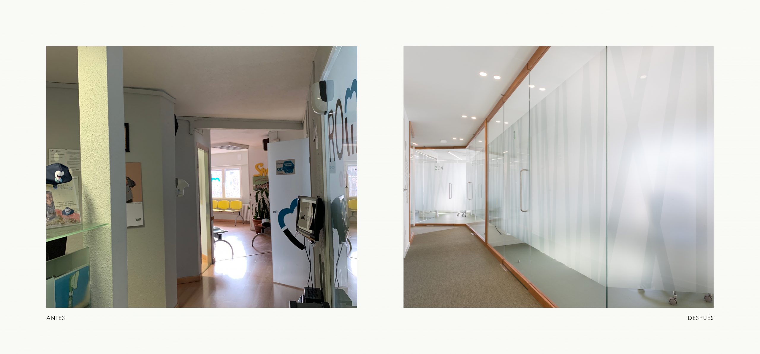 Romina Barbieri - clinica dental doctores romero_romina barbieri_madrid_antes y despues_2