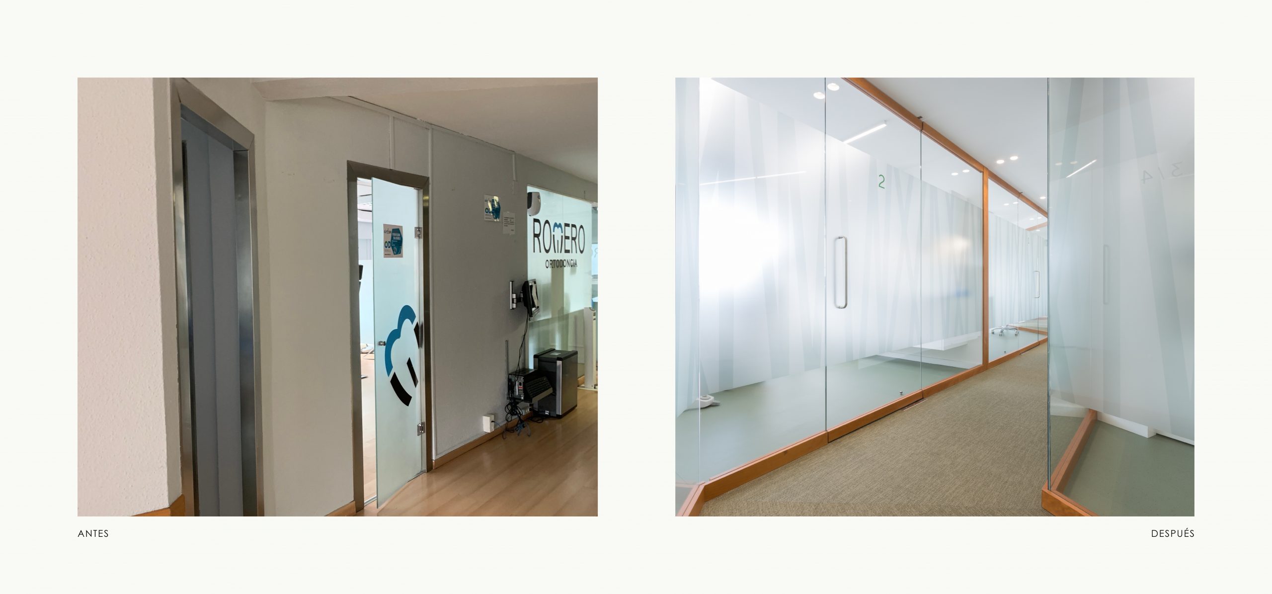 Romina Barbieri - clinica dental doctores romero_romina barbieri_madrid_antes y despues_3