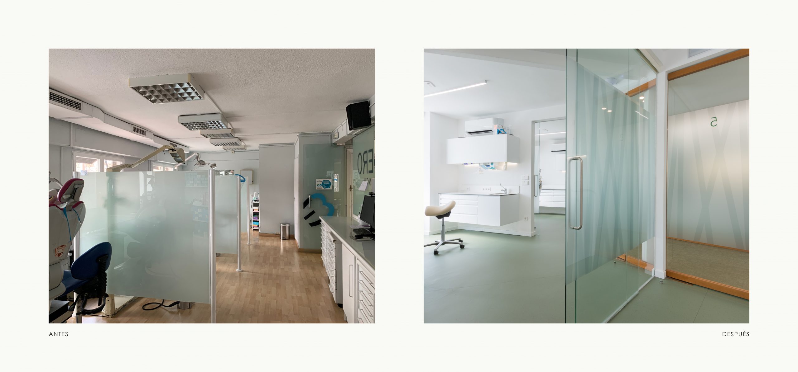 Romina Barbieri - clinica dental doctores romero_romina barbieri_madrid_antes y despues_4