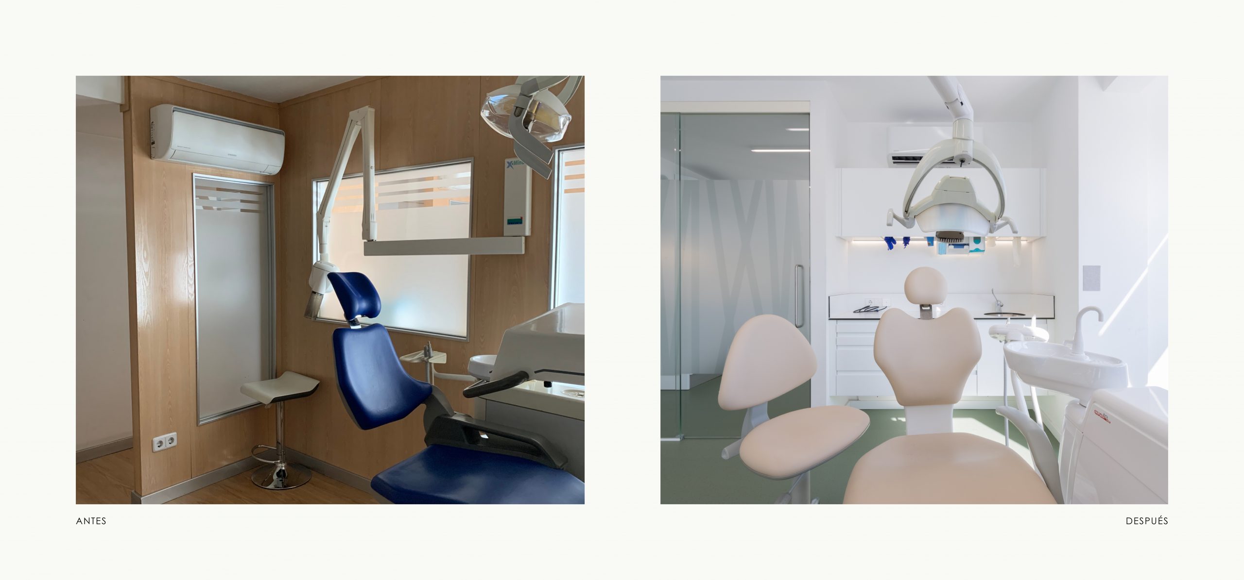 Romina Barbieri - clinica dental doctores romero_romina barbieri_madrid_antes y despues_5