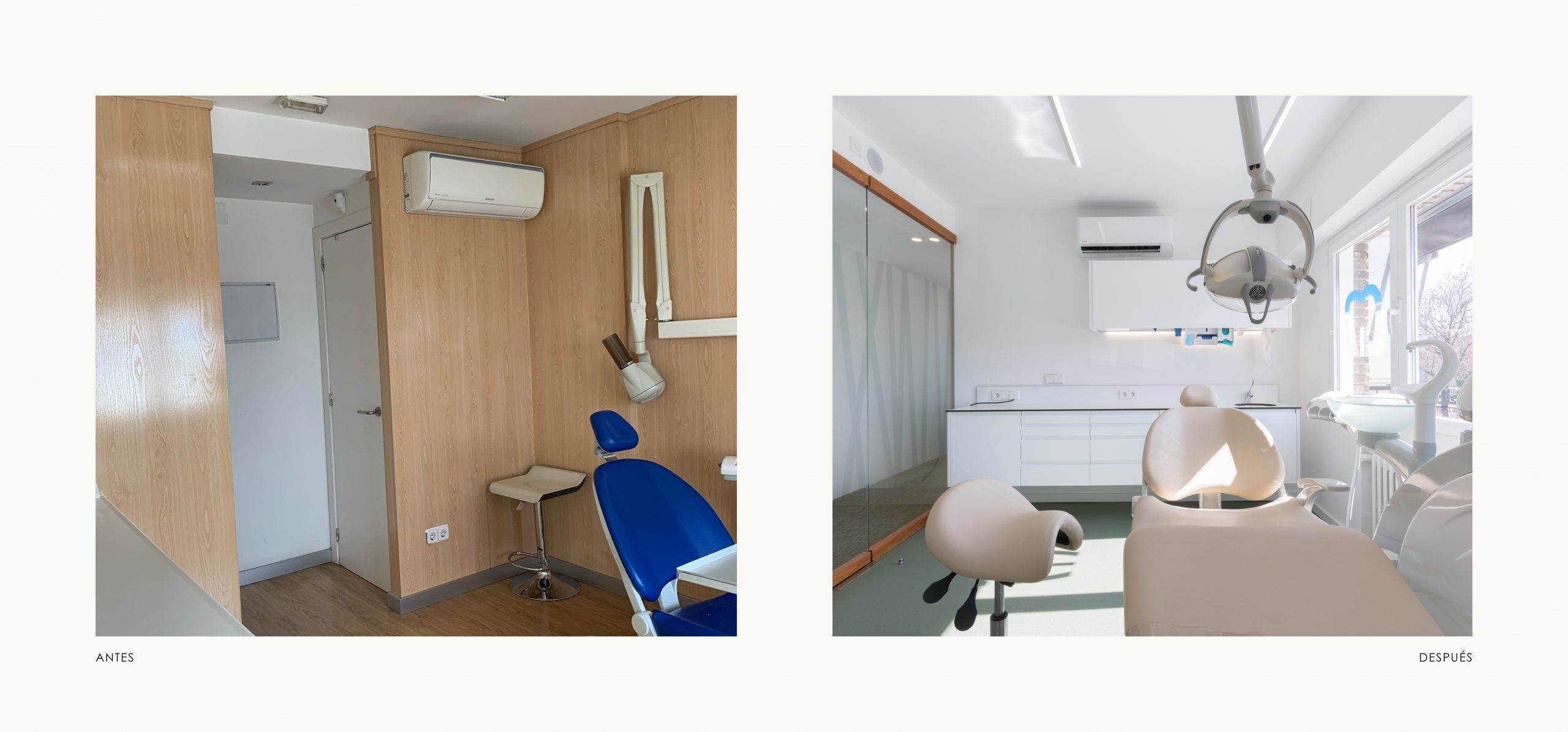 Romina Barbieri - clinica dental doctores romero_romina barbieri_madrid_antes y despues_6