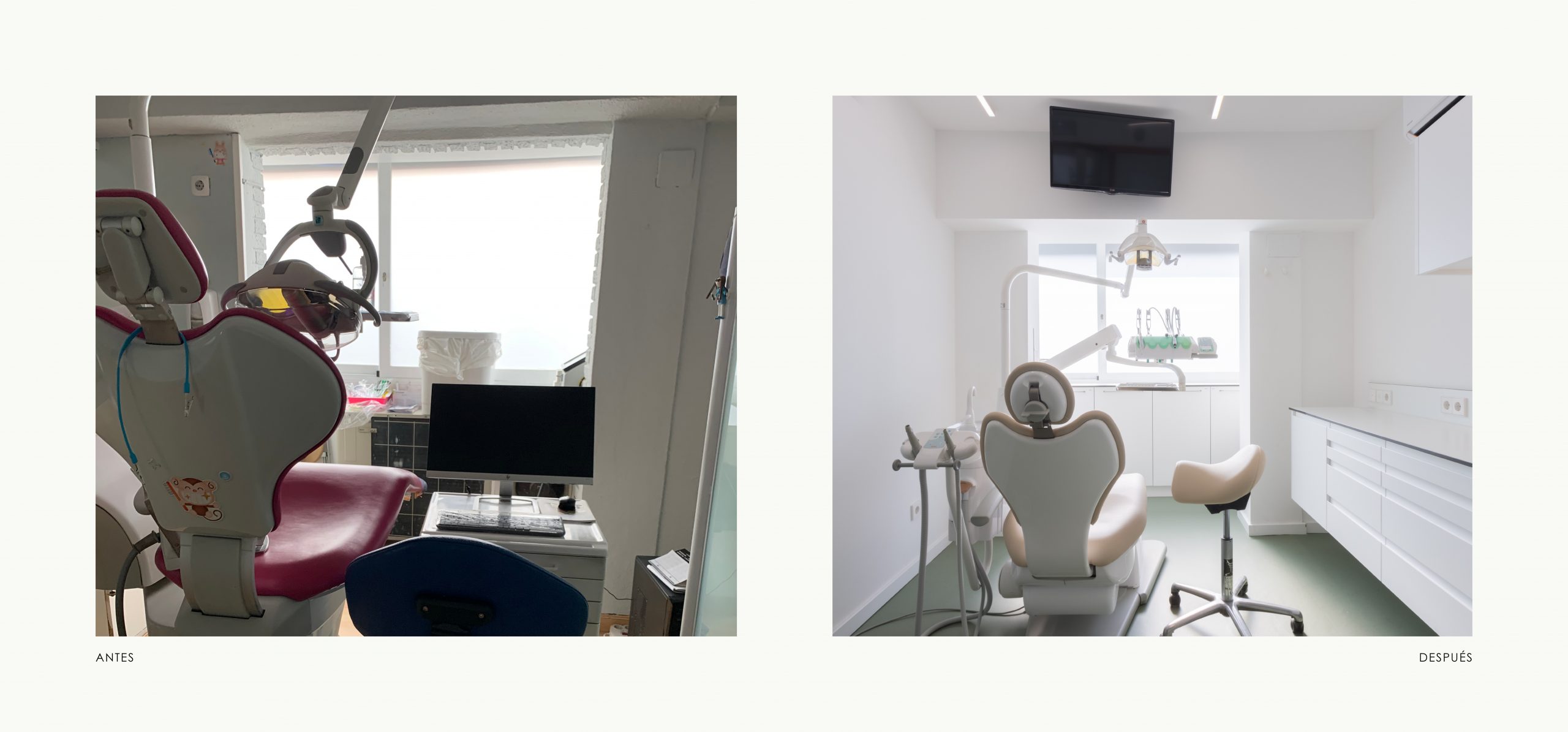 Romina Barbieri - clinica dental doctores romero_romina barbieri_madrid_antes y despues_7