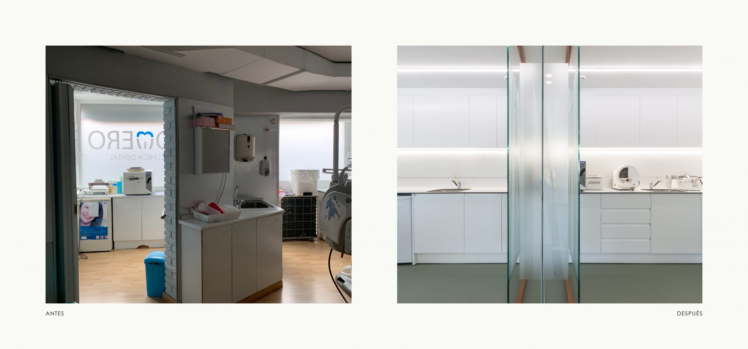 Romina Barbieri - clinica dental doctores romero_romina barbieri_madrid_antes y despues_8