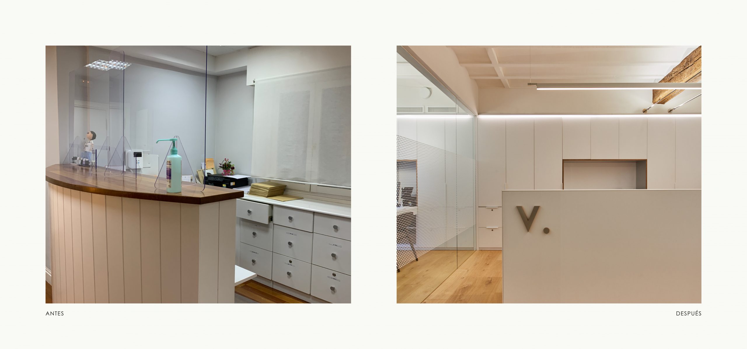 Romina Barbieri - clinica dental vijande_periodoncia e implantes_romina barbieri_antes y despues_2