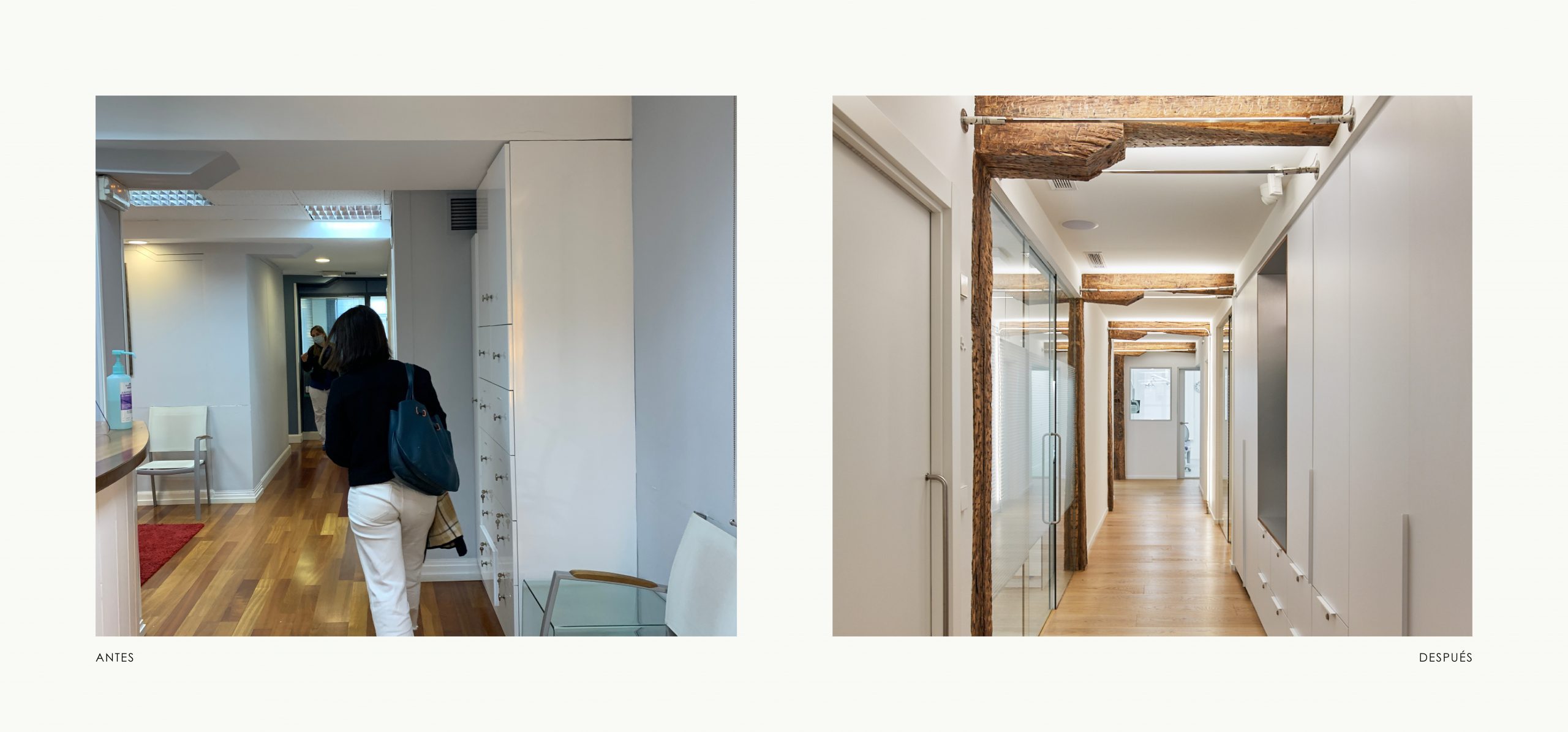 Romina Barbieri - clinica dental vijande_periodoncia e implantes_romina barbieri_antes y despues_3