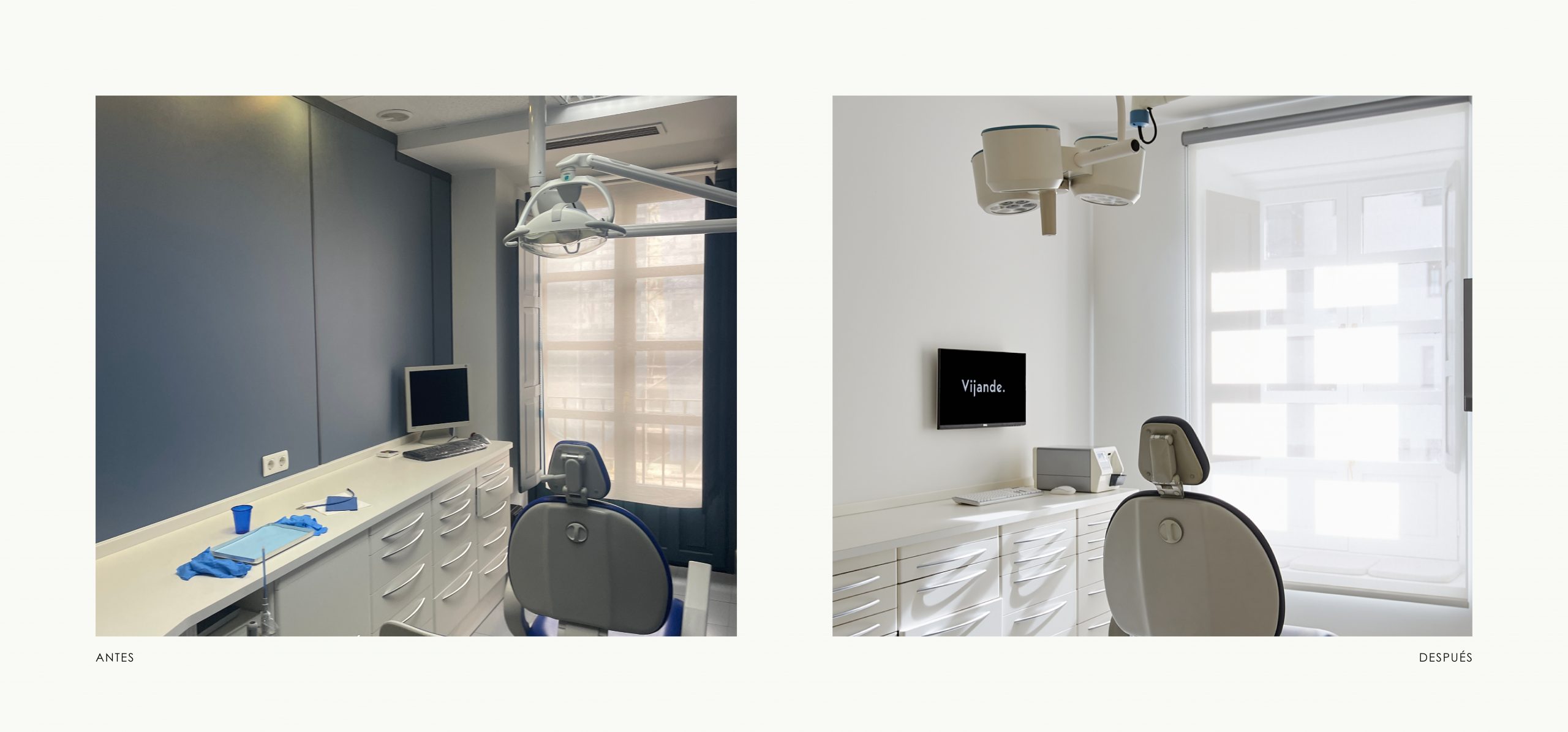 Romina Barbieri - clinica dental vijande_periodoncia e implantes_romina barbieri_antes y despues_5