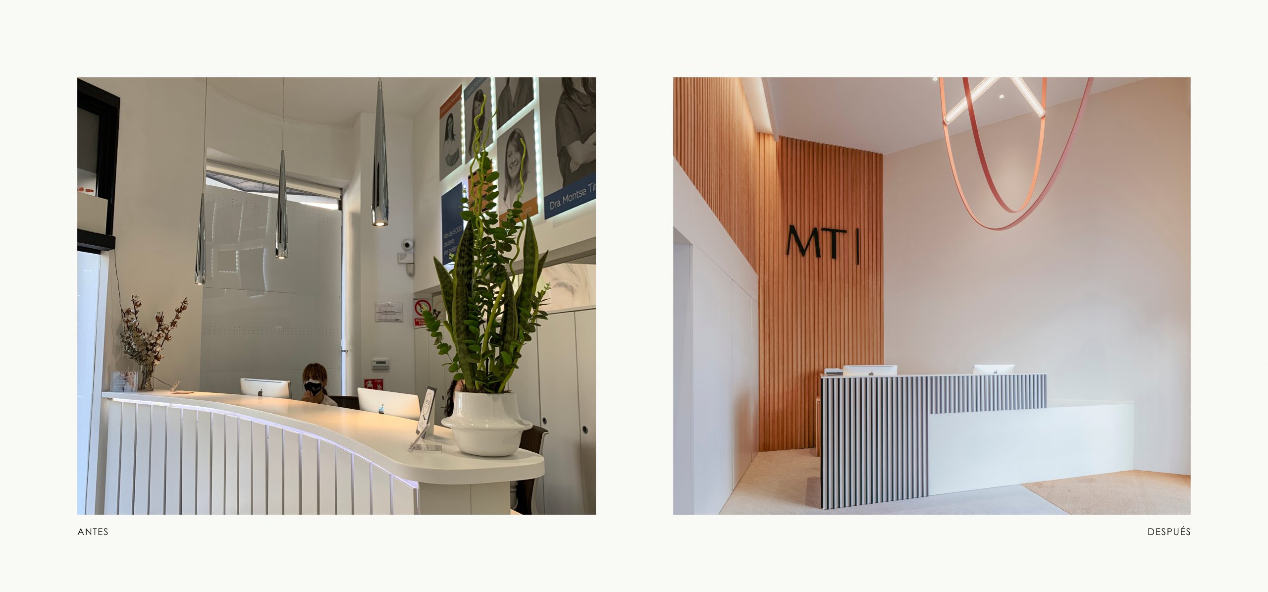 Romina Barbieri - Clinica Dental Montse Timoneda_Romina Barbieri_Tarragona_antes y despues_