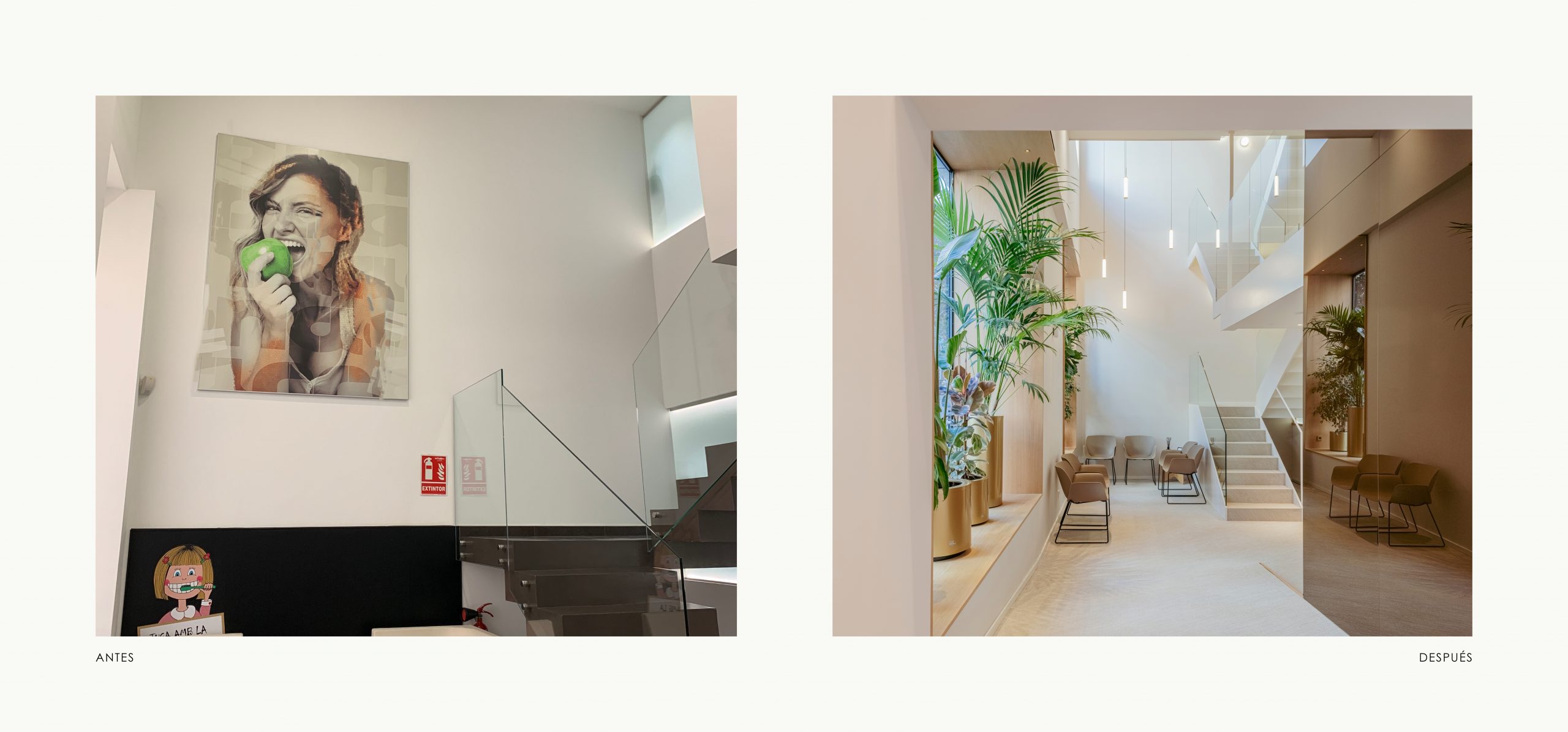 Romina Barbieri - Clinica Dental Montse Timoneda_Romina Barbieri_Tarragona_antes y despues_2