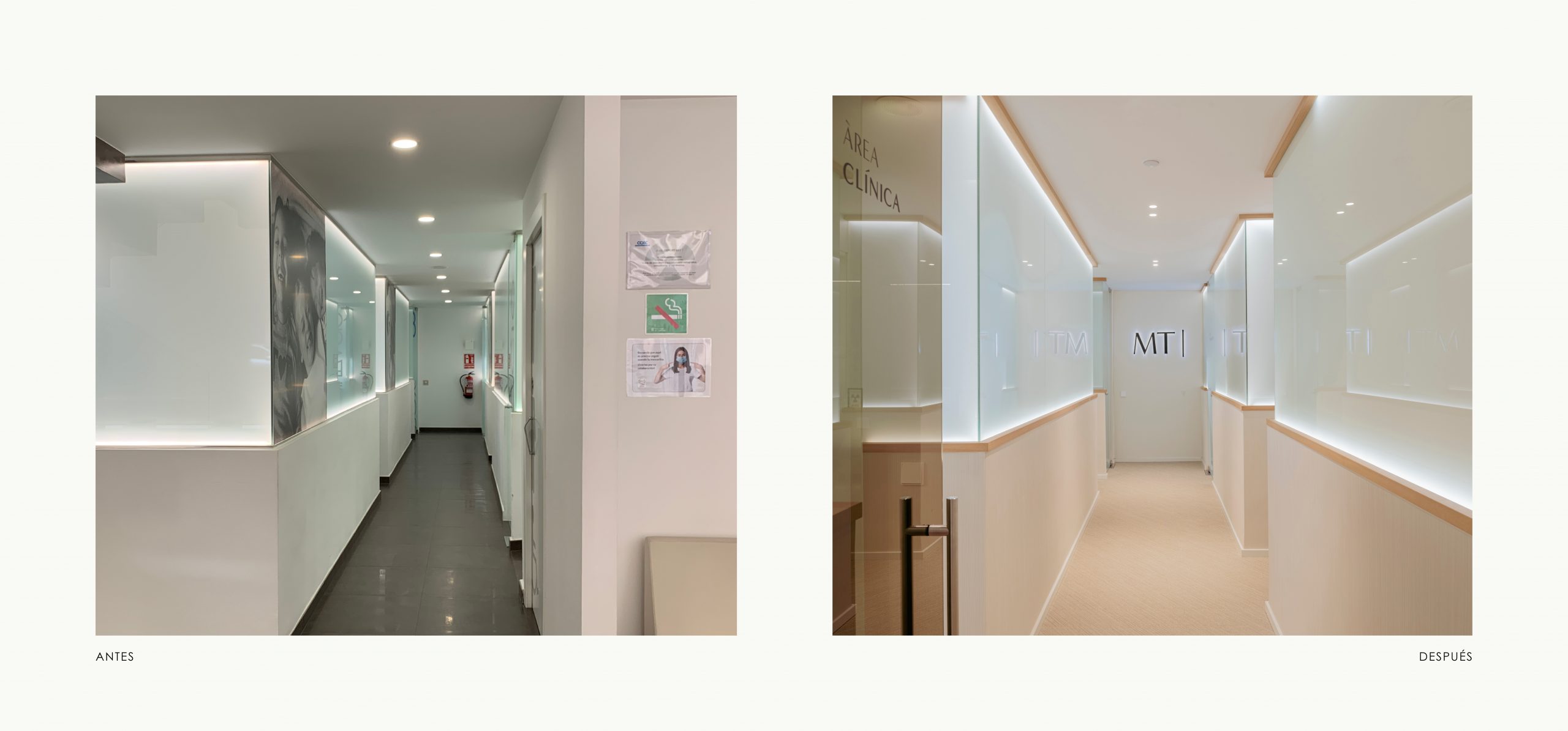 Romina Barbieri - Clinica Dental Montse Timoneda_Romina Barbieri_Tarragona_antes y despues_3