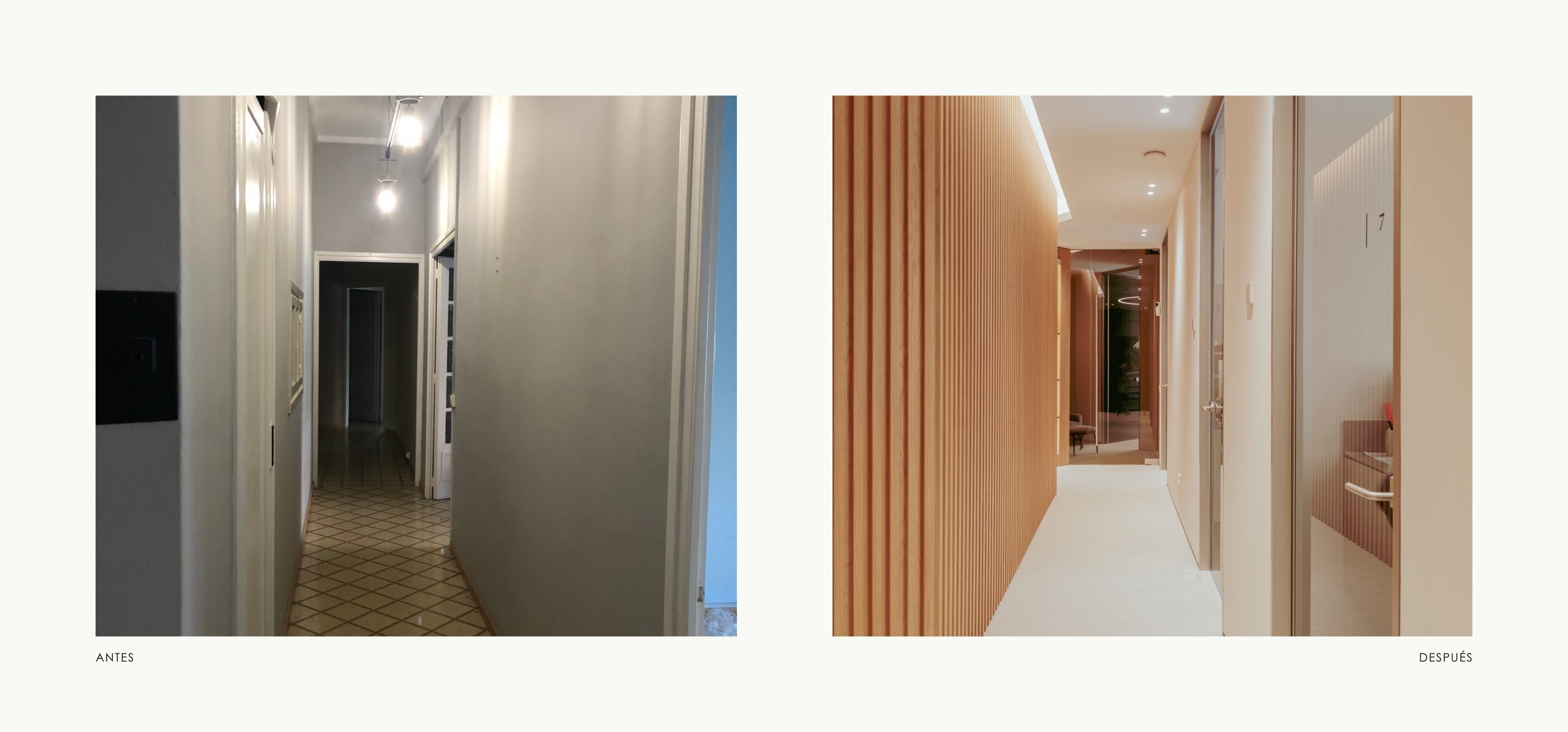 Romina Barbieri - Clinica Dental Montse Timoneda_Romina Barbieri_Tarragona_antes y despues_7