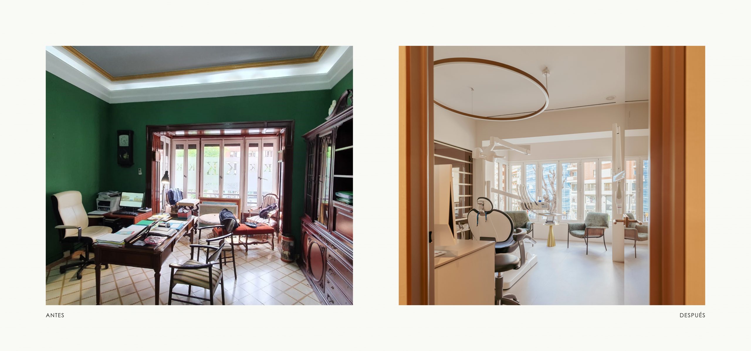 Romina Barbieri - Clinica Dental Montse Timoneda_Romina Barbieri_Tarragona_antes y despues_8