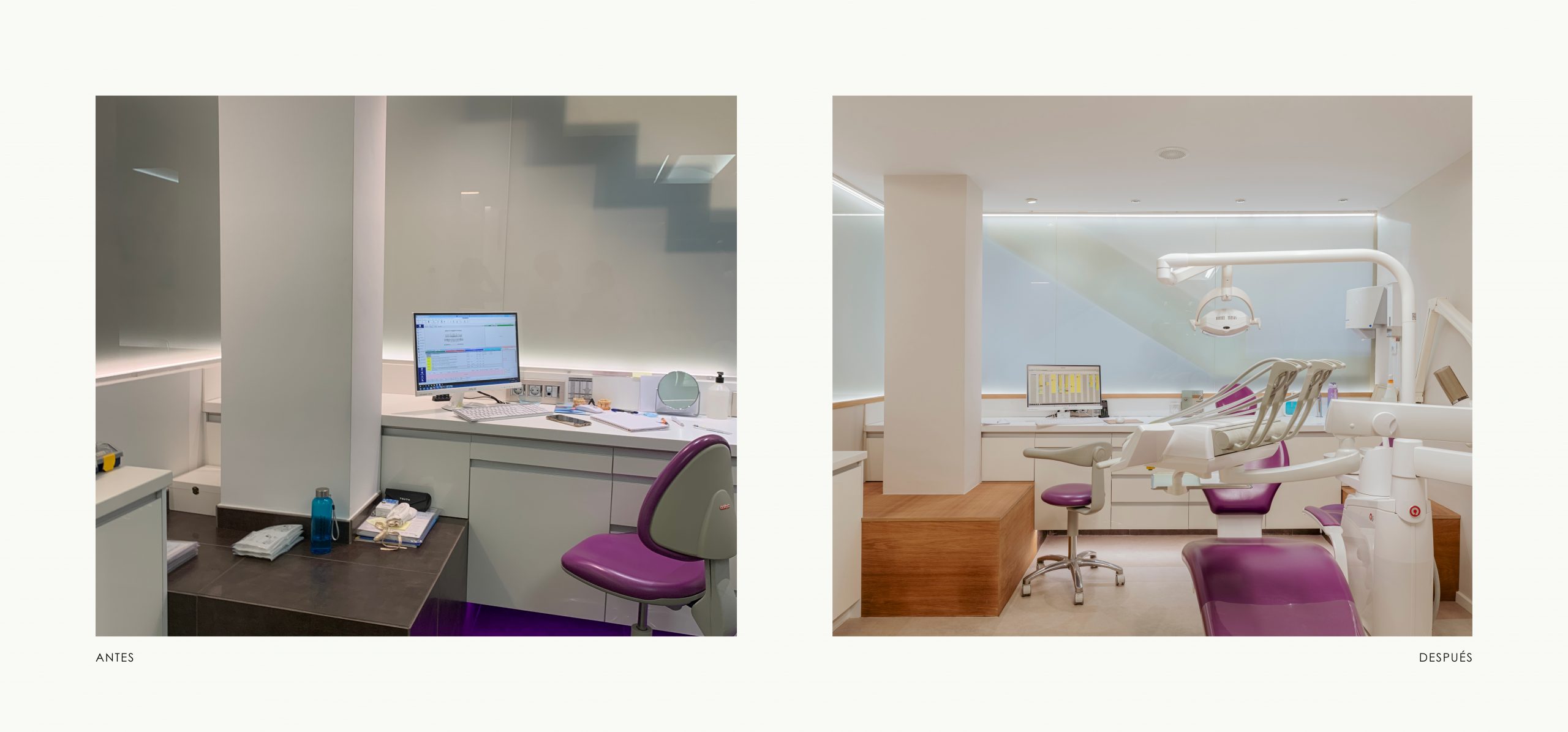 Romina Barbieri - Clinica Dental Montse Timoneda_Romina Barbieri_Tarragona_antes y despues_9