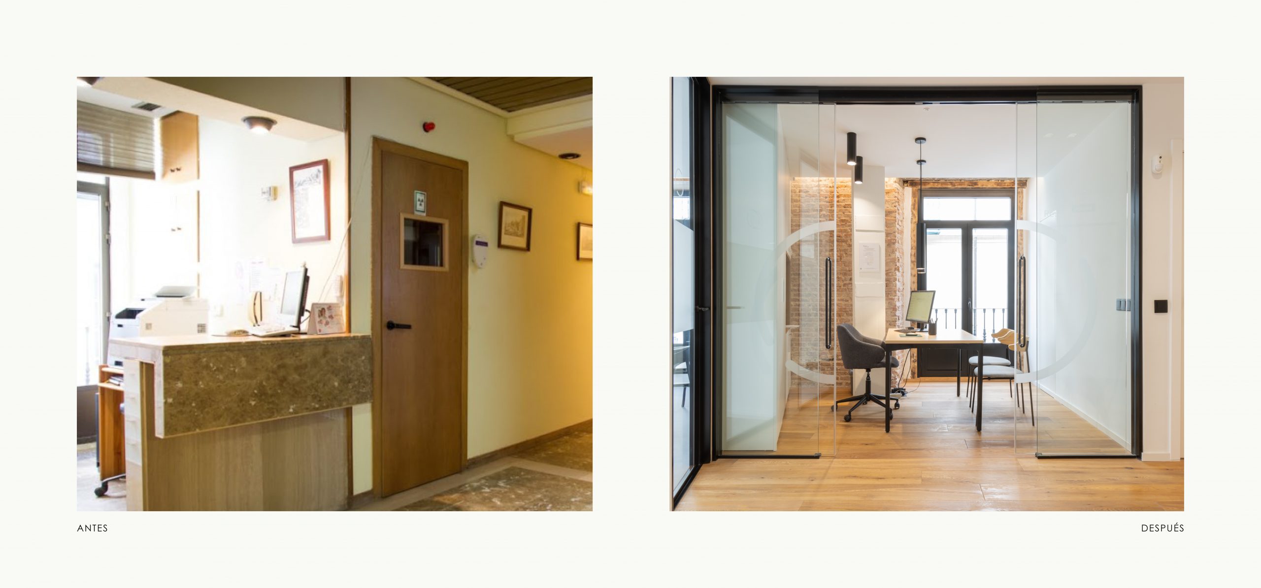 Romina Barbieri - Clinica Dental_Nieto Cano Salud_Romina Barbieri_Valladolid_Antes y despues_