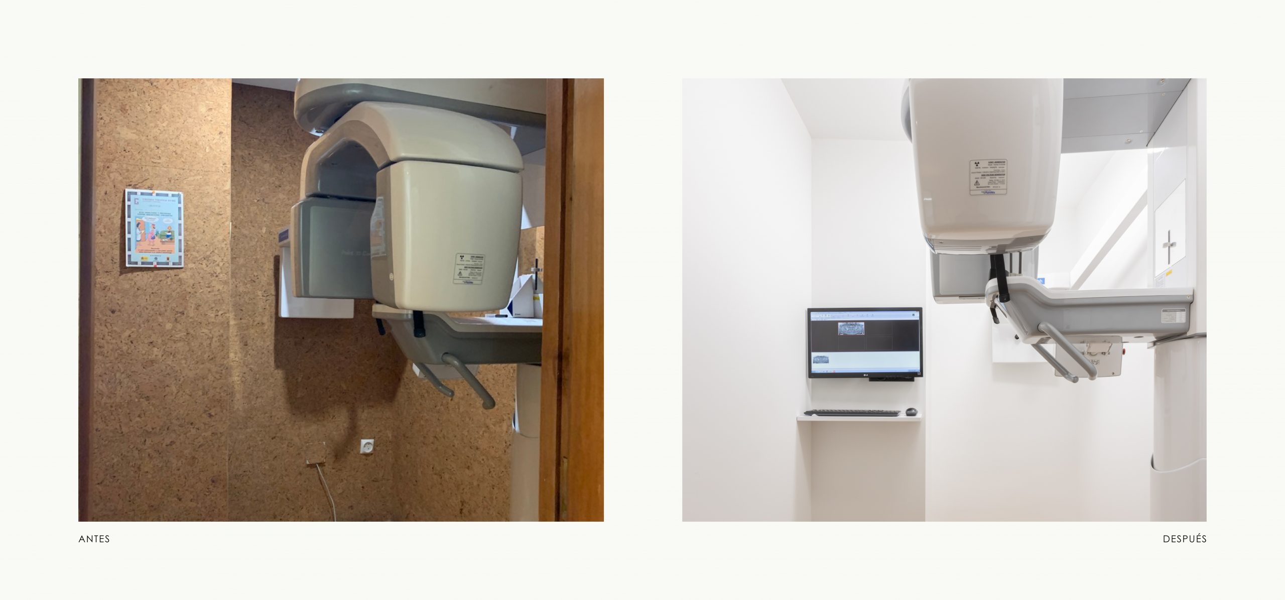 Romina Barbieri - Clinica Dental_Nieto Cano Salud_Romina Barbieri_Valladolid_Antes y despues_10