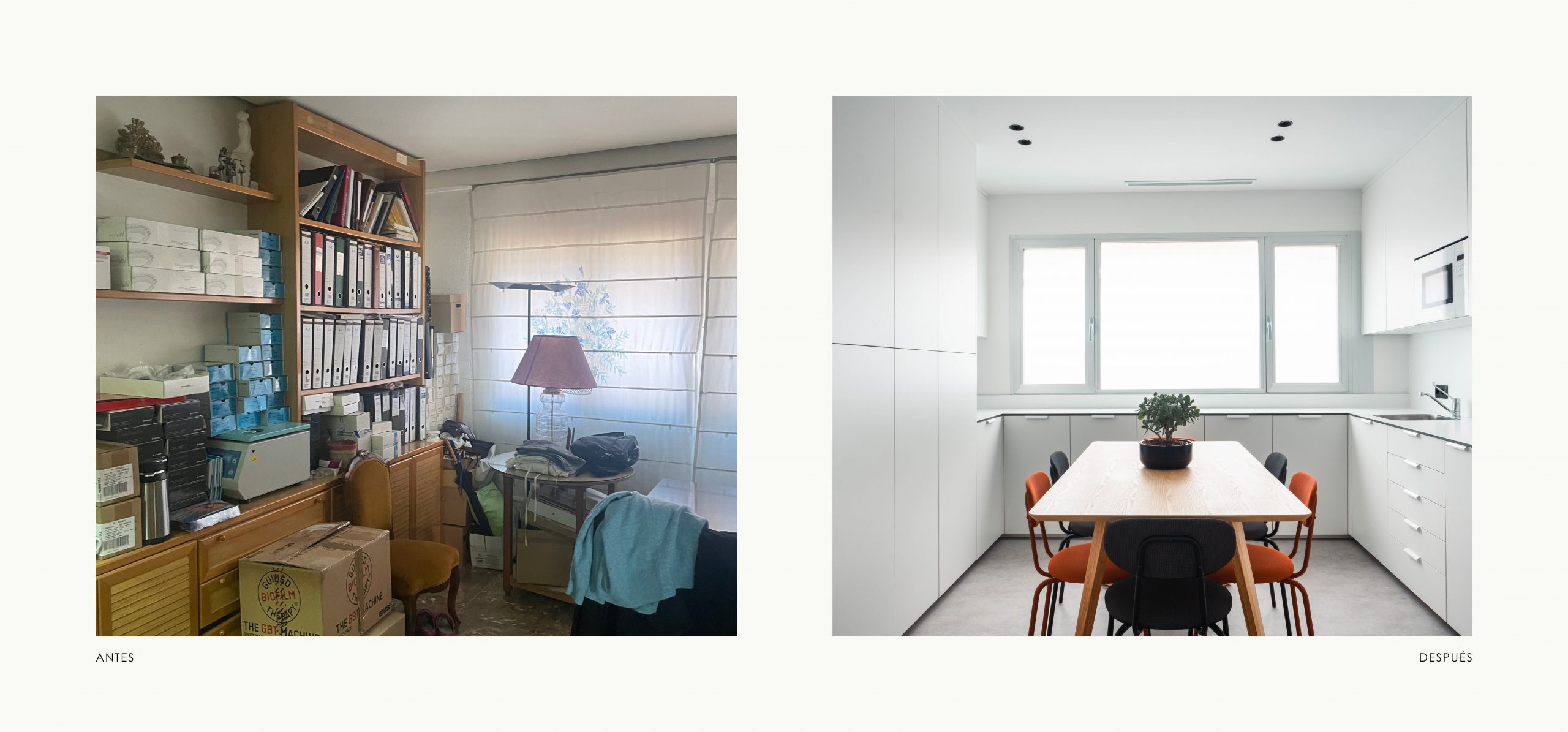 Romina Barbieri - Clinica Dental_Nieto Cano Salud_Romina Barbieri_Valladolid_Antes y despues_11