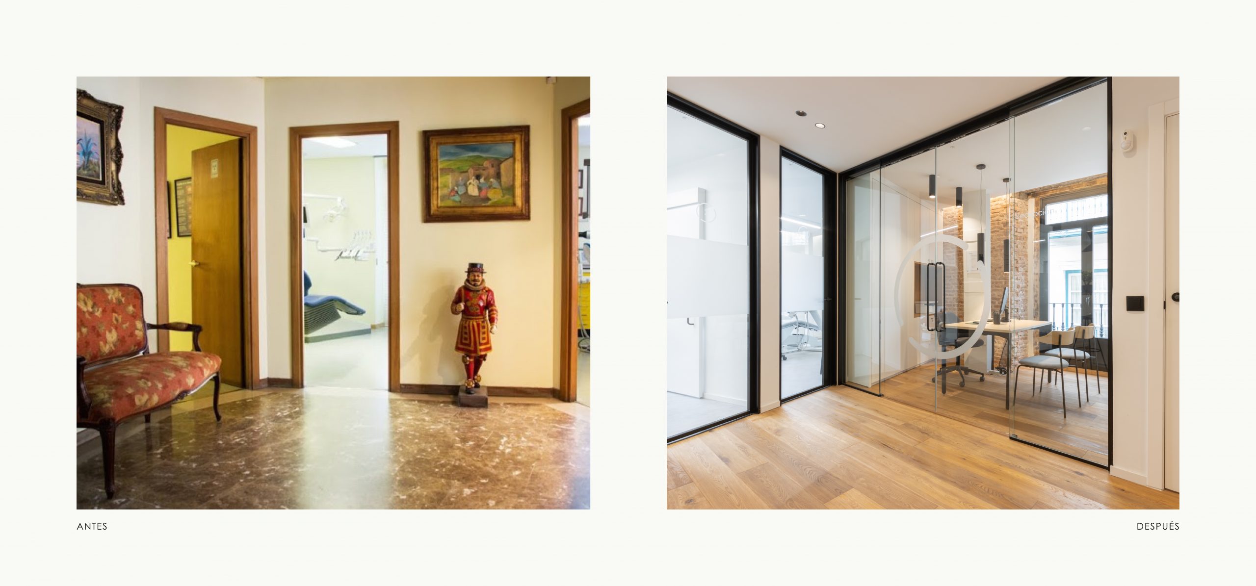 Romina Barbieri - Clinica Dental_Nieto Cano Salud_Romina Barbieri_Valladolid_Antes y despues_2