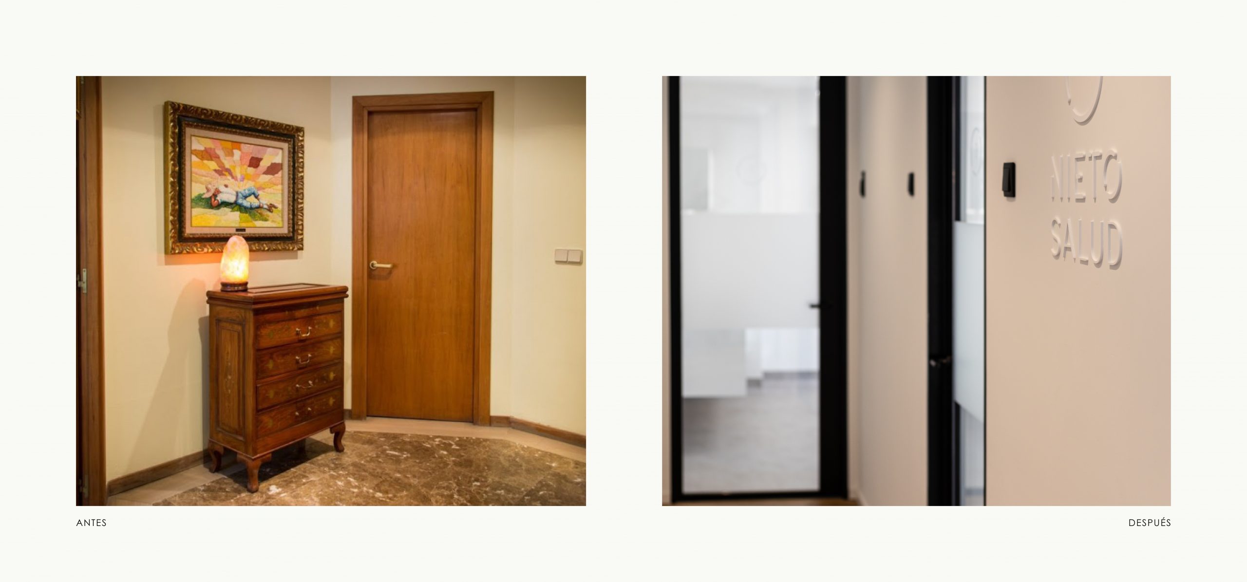 Romina Barbieri - Clinica Dental_Nieto Cano Salud_Romina Barbieri_Valladolid_Antes y despues_3