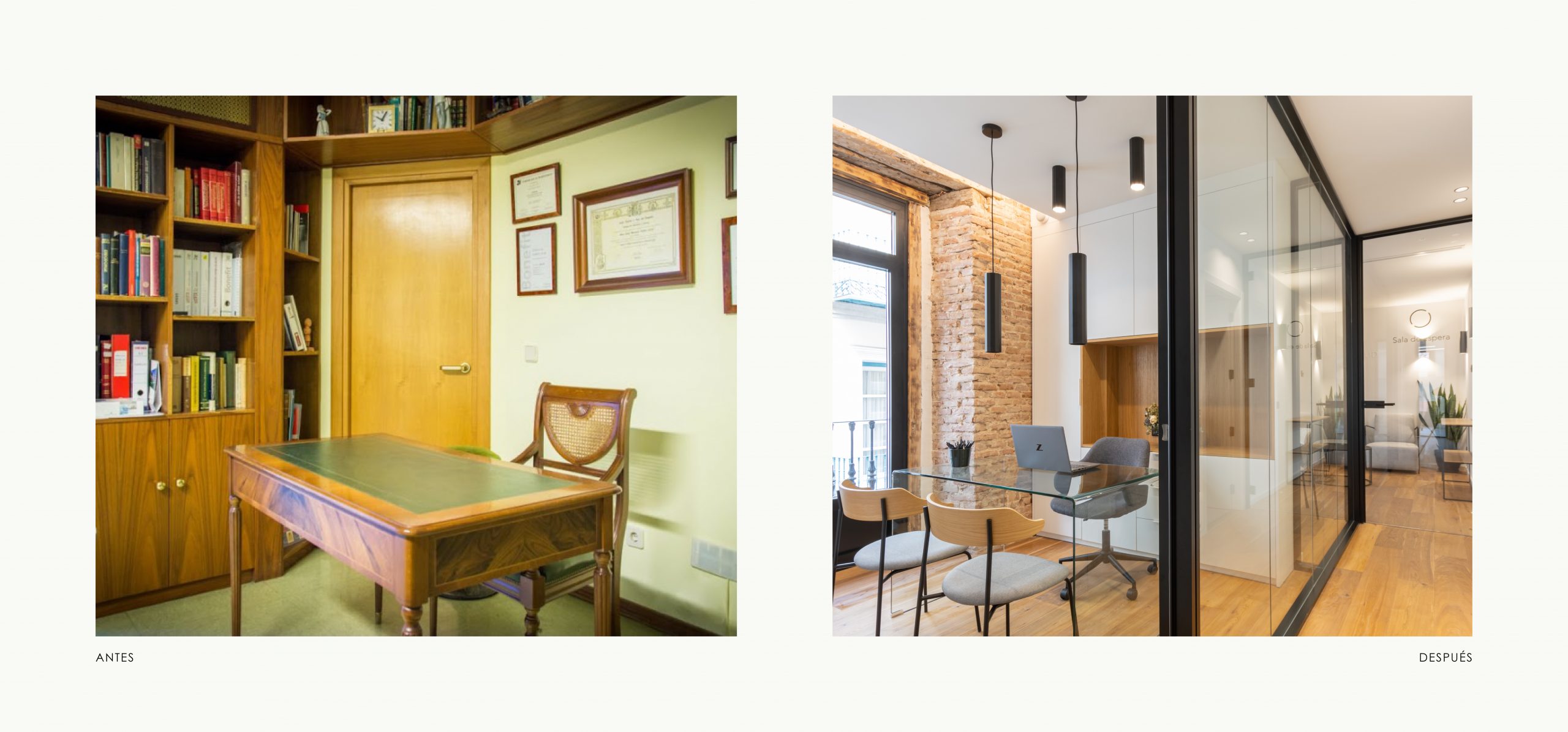 Romina Barbieri - Clinica Dental_Nieto Cano Salud_Romina Barbieri_Valladolid_Antes y despues_4