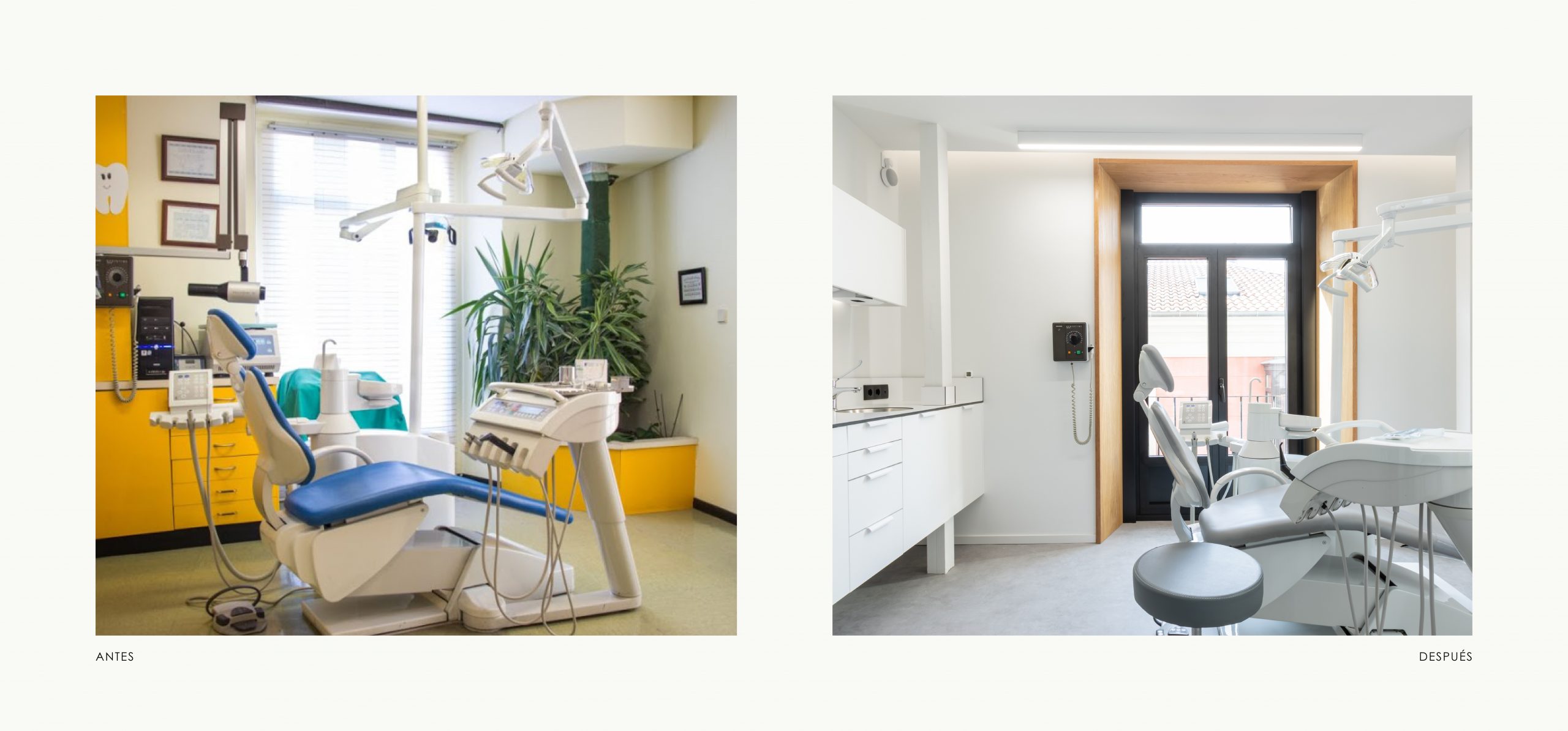 Romina Barbieri - Clinica Dental_Nieto Cano Salud_Romina Barbieri_Valladolid_Antes y despues_5