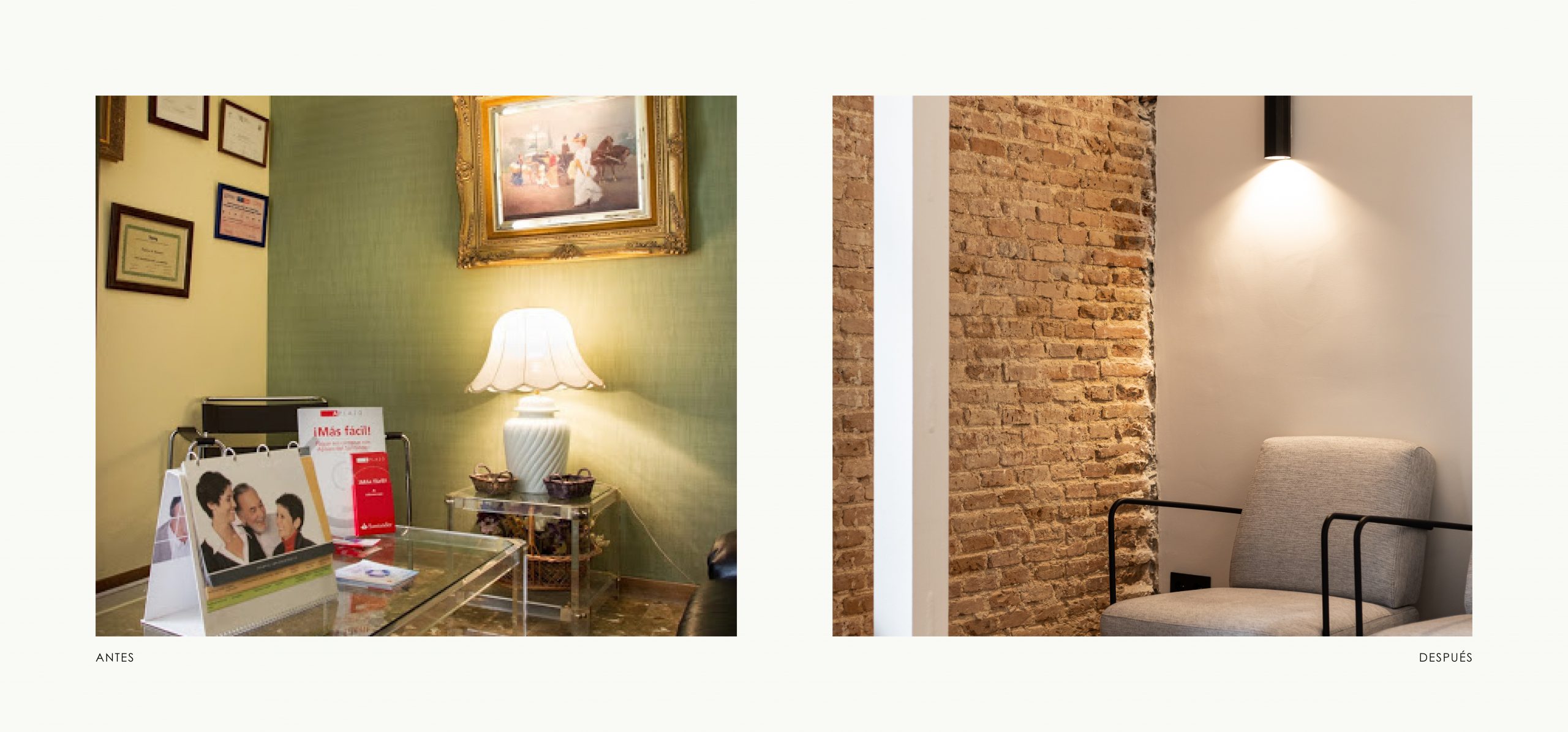 Romina Barbieri - Clinica Dental_Nieto Cano Salud_Romina Barbieri_Valladolid_Antes y despues_6