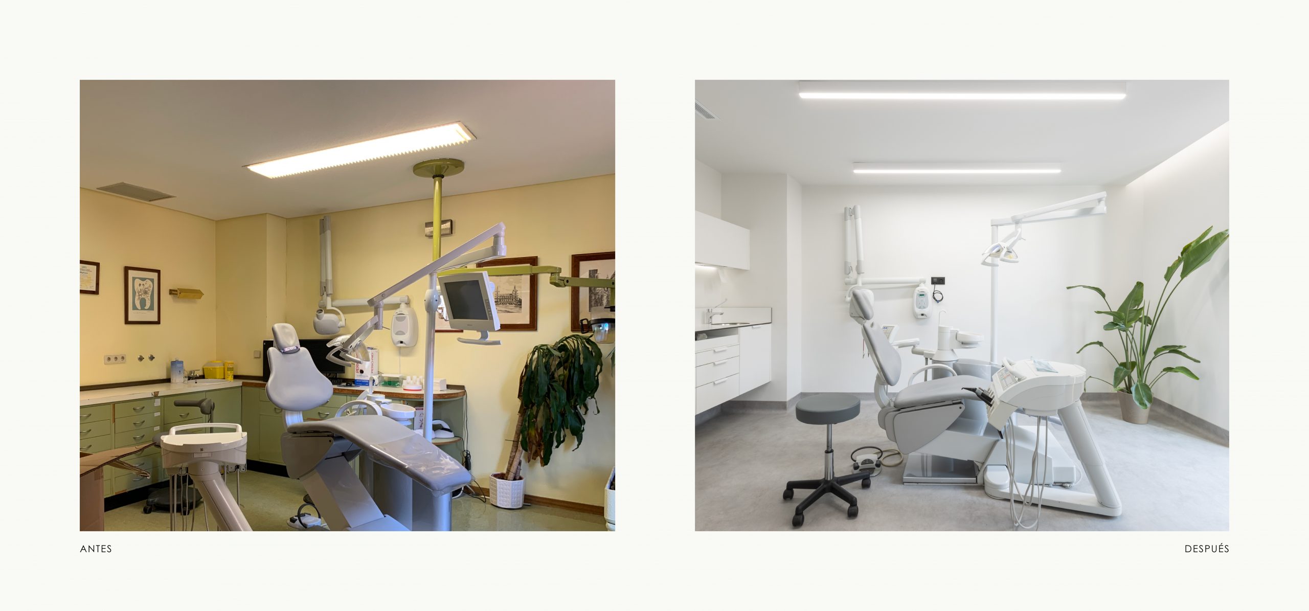 Romina Barbieri - Clinica Dental_Nieto Cano Salud_Romina Barbieri_Valladolid_Antes y despues_8