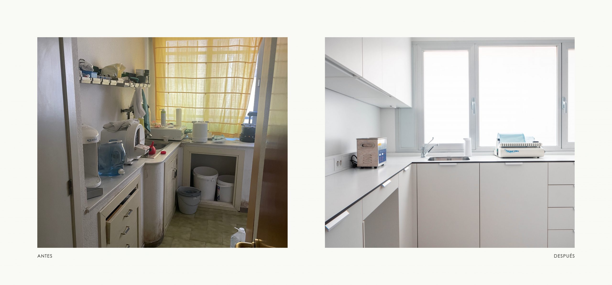 Romina Barbieri - Clinica Dental_Nieto Cano Salud_Romina Barbieri_Valladolid_Antes y despues_9